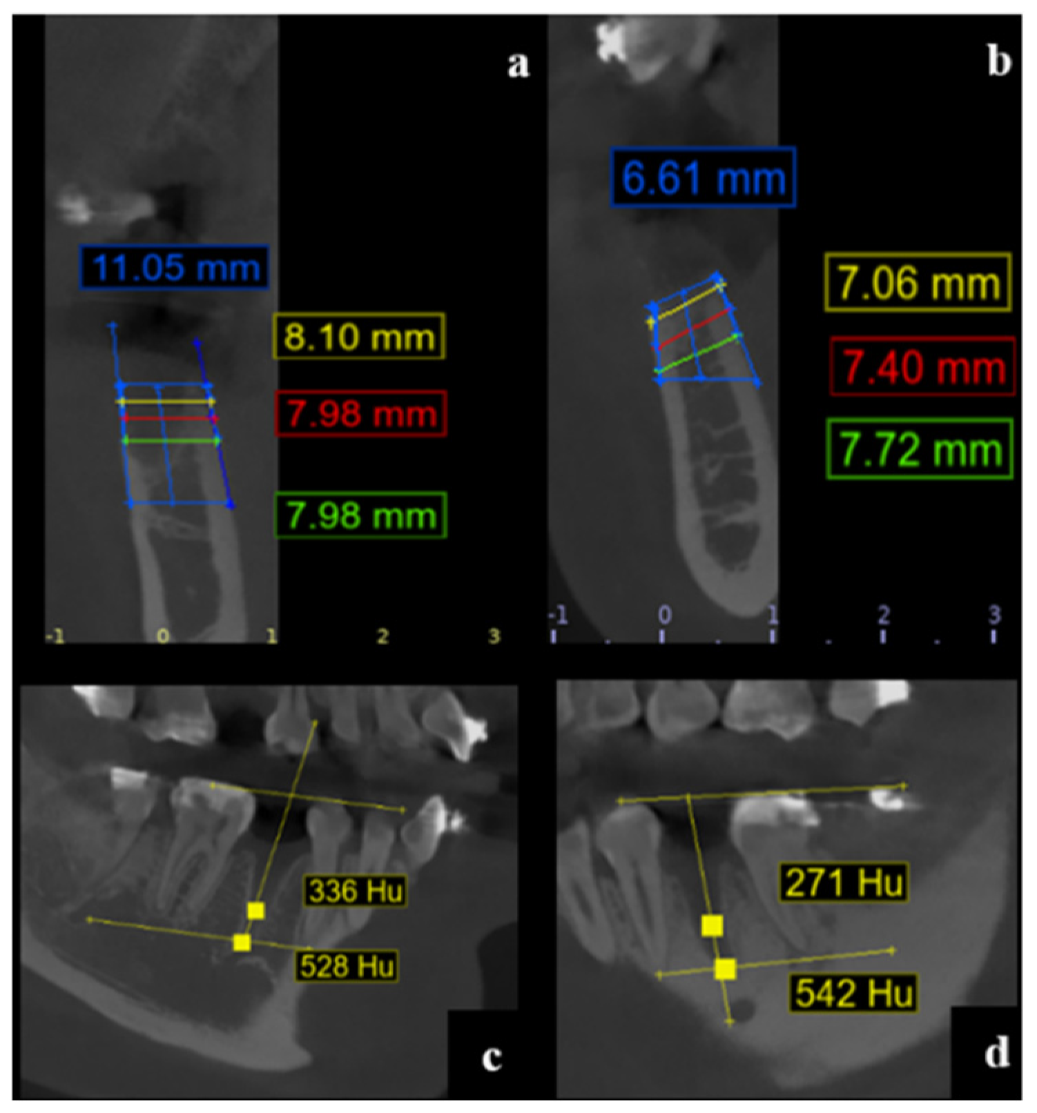 Dentistry 13 00231 g003