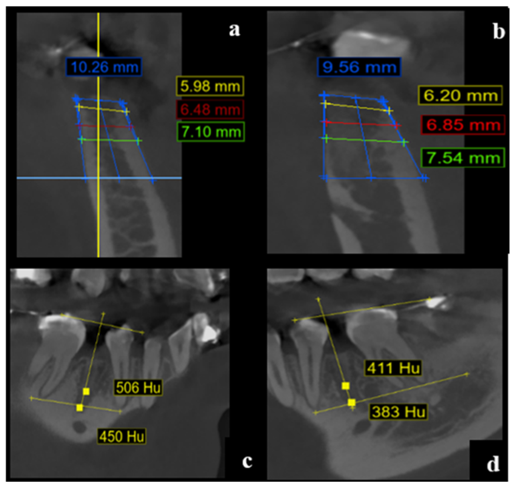 Dentistry 13 00231 g004
