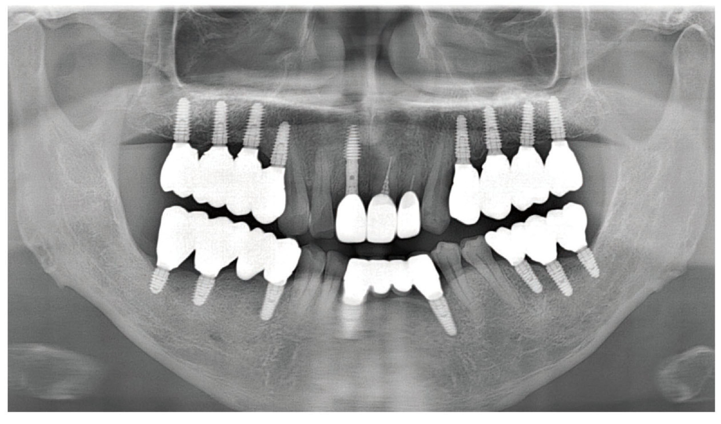 Dentistry 13 00241 g015