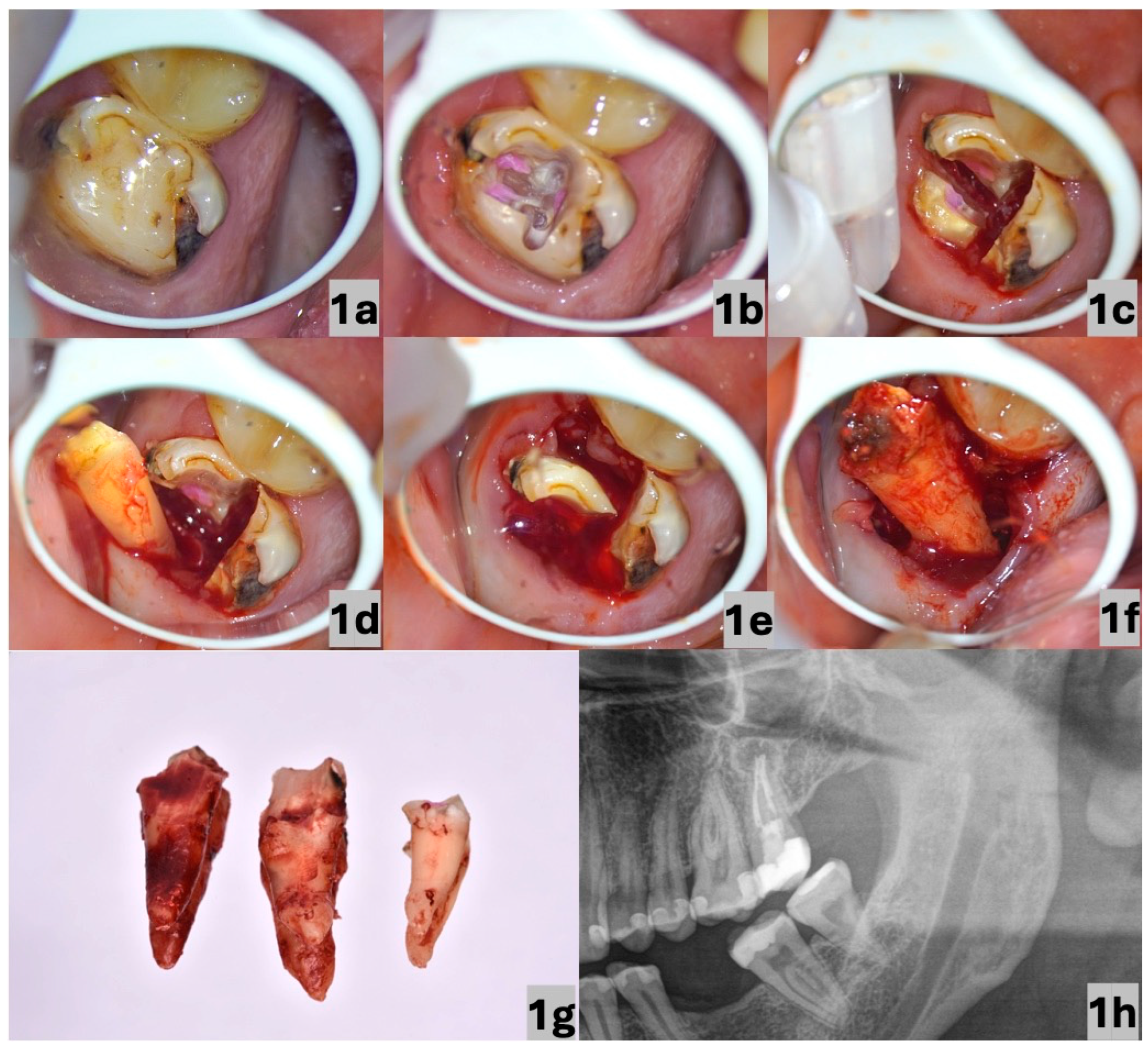 Dentistry 13 00243 g001
