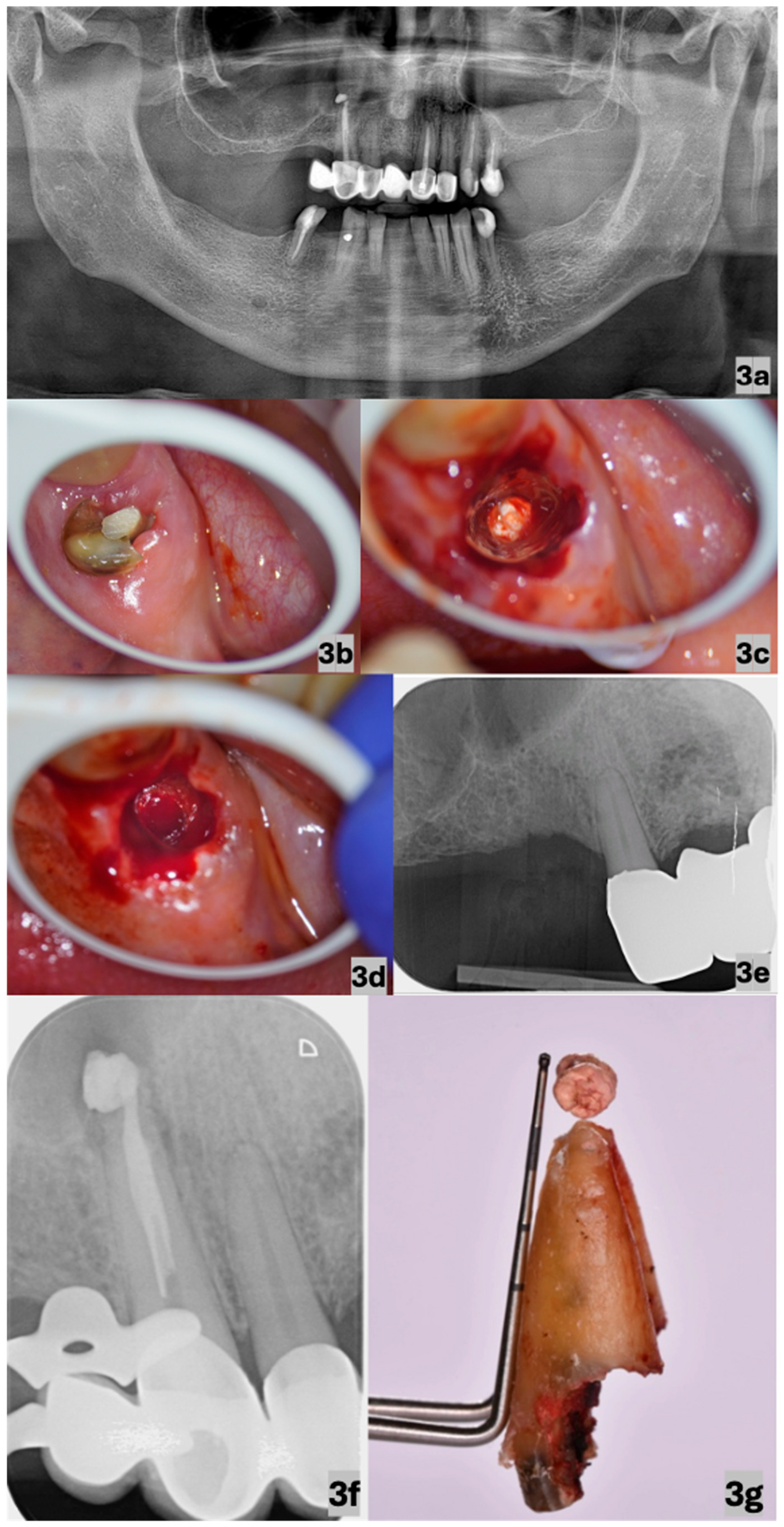 Dentistry 13 00243 g003
