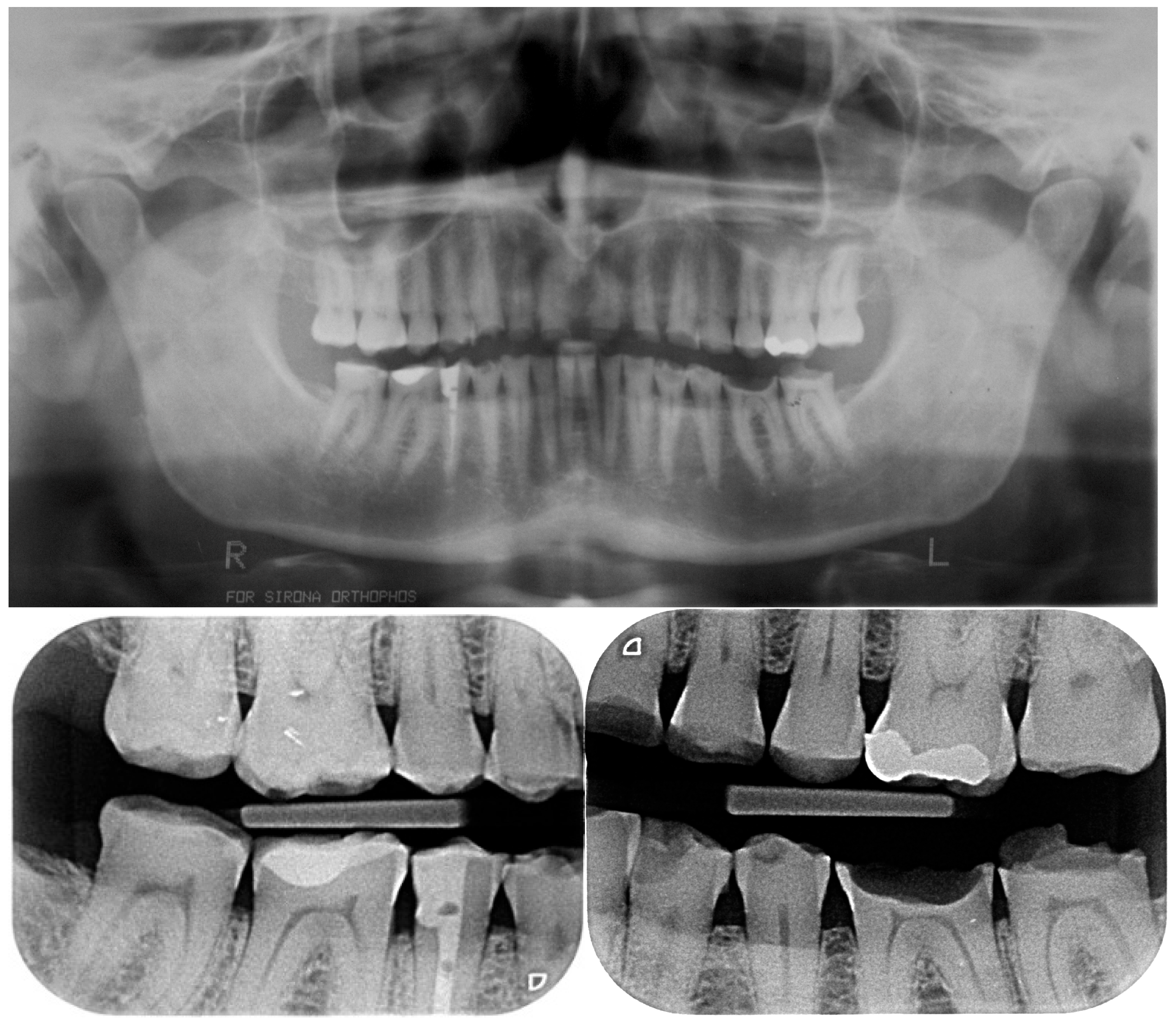 Dentistry 13 00259 g005a