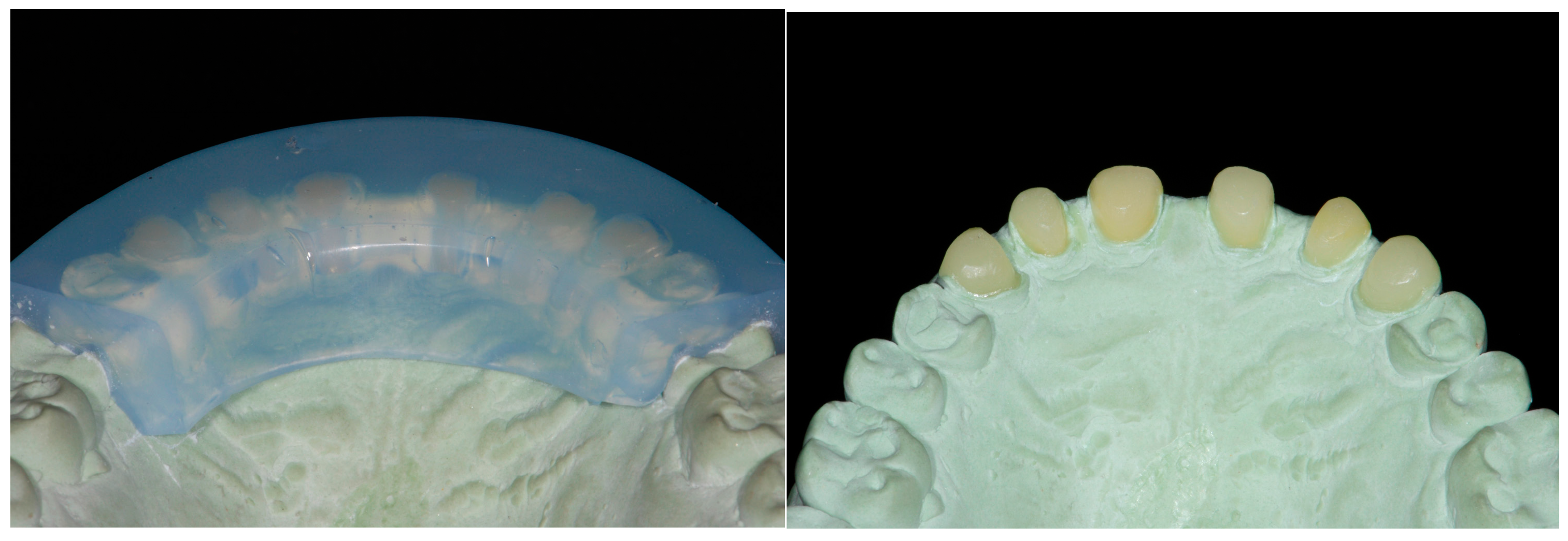 Dentistry 13 00259 g008a