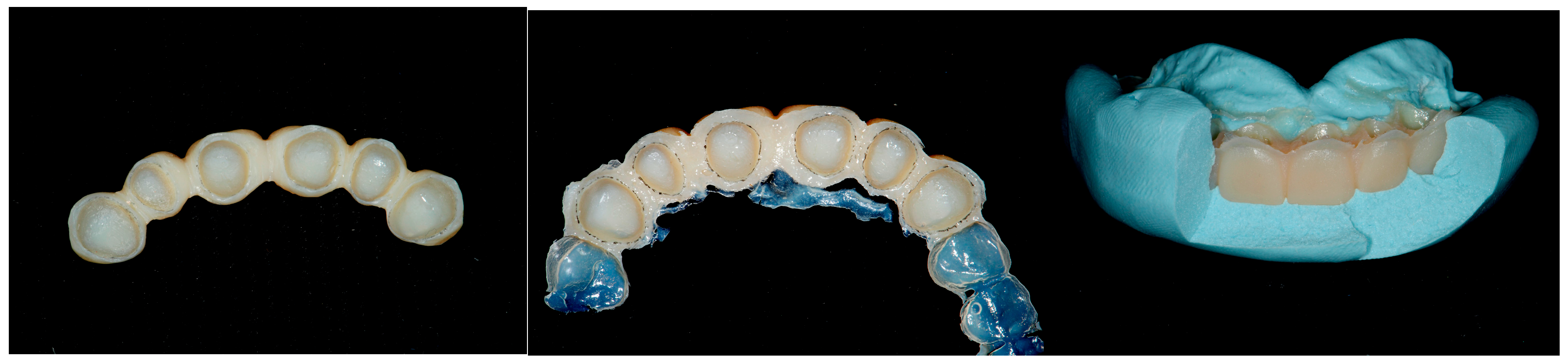 Dentistry 13 00259 g013
