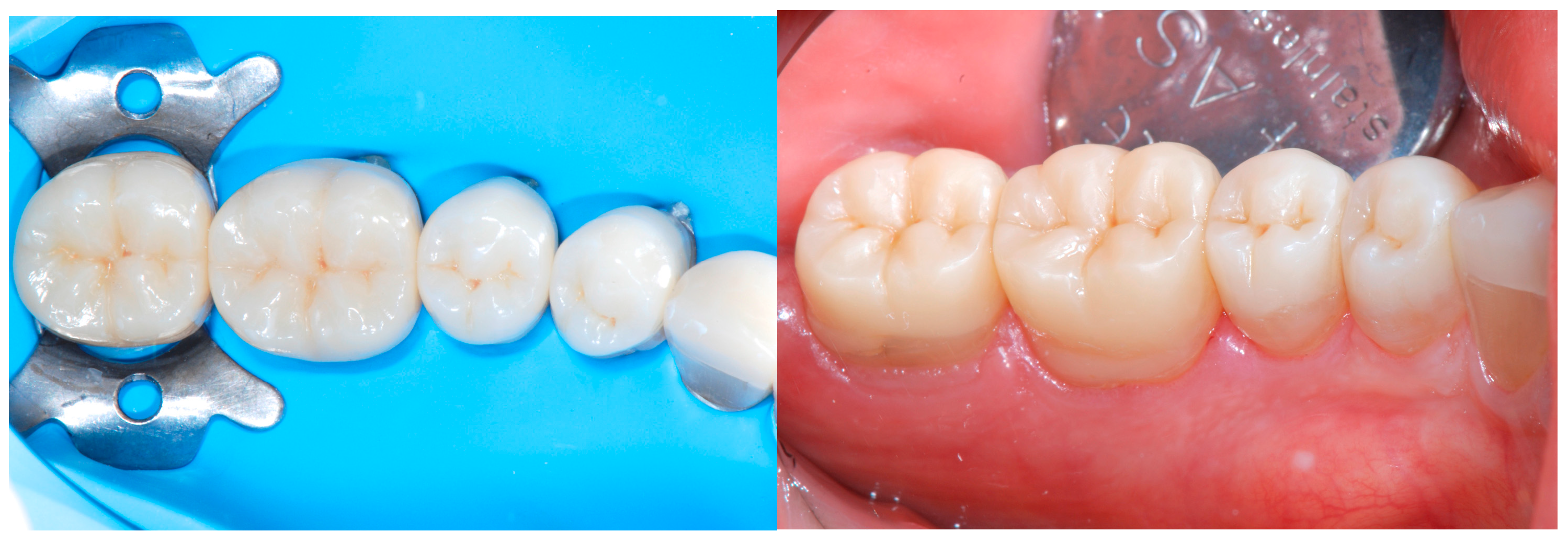 Dentistry 13 00259 g021