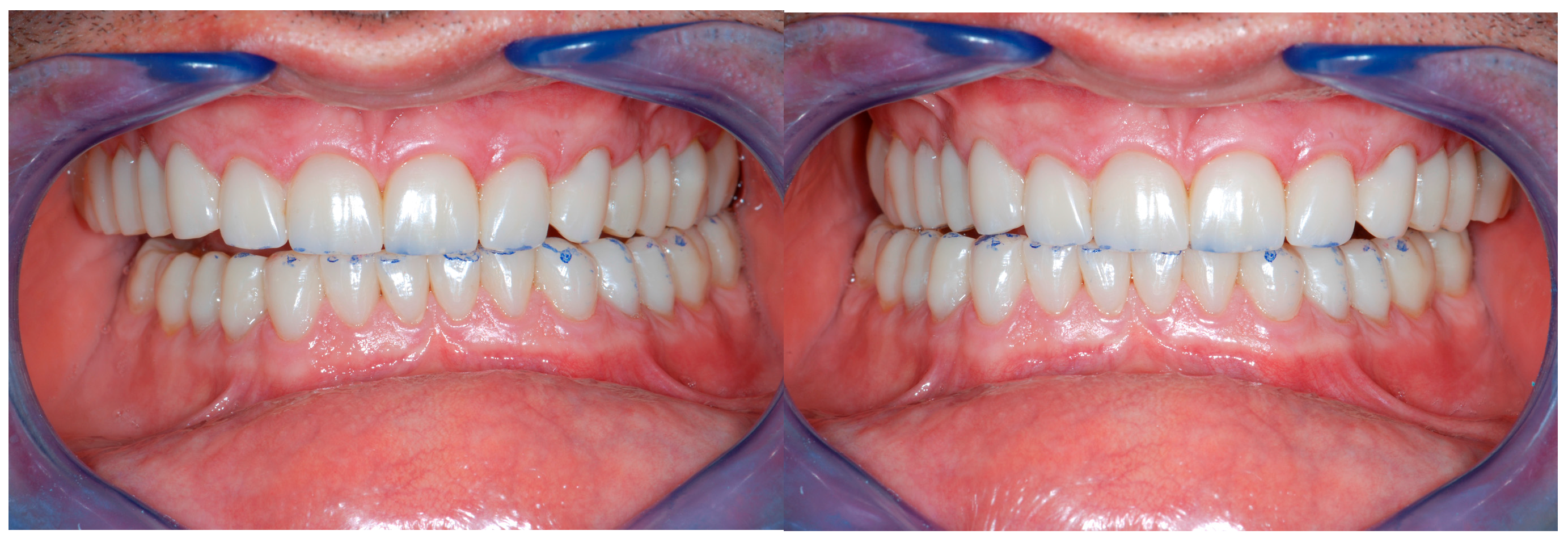 Dentistry 13 00259 g025a