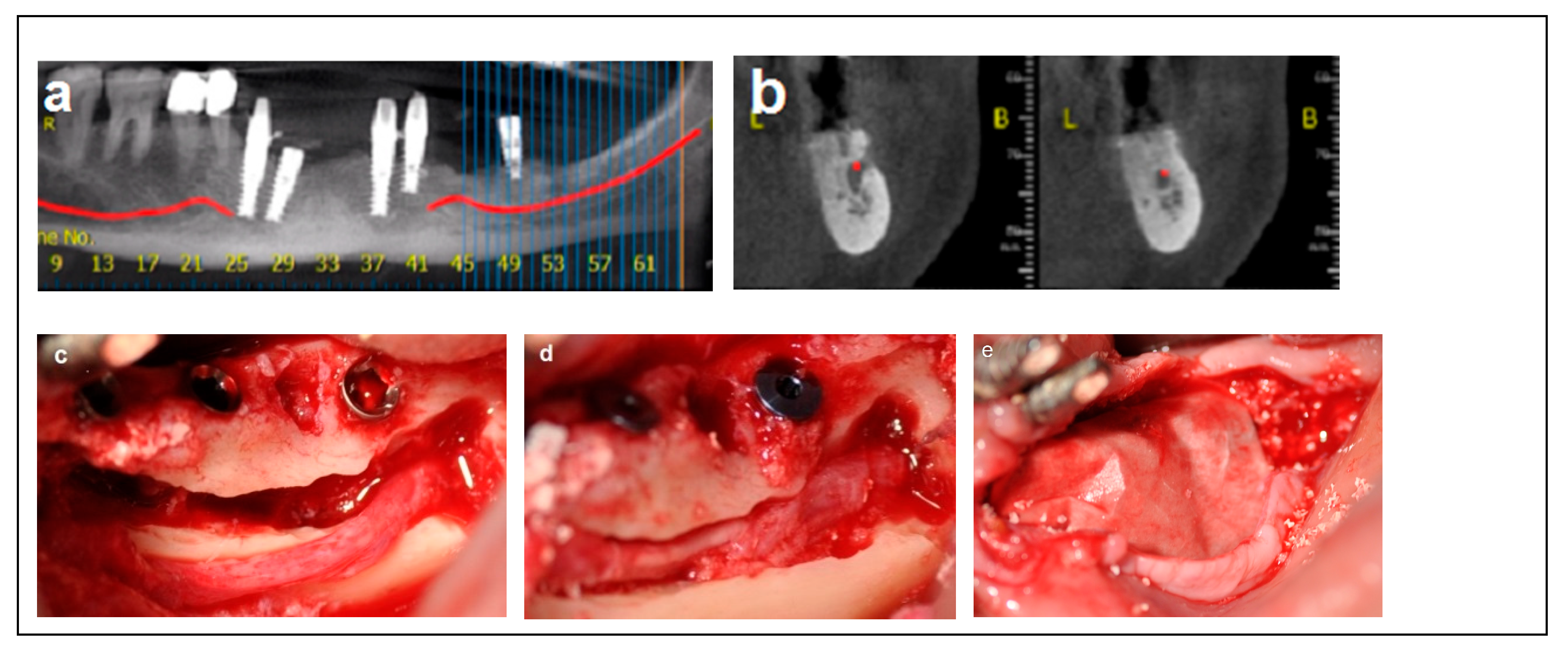 Dentistry 13 00267 g002a Dentistry 13 00267 g002a