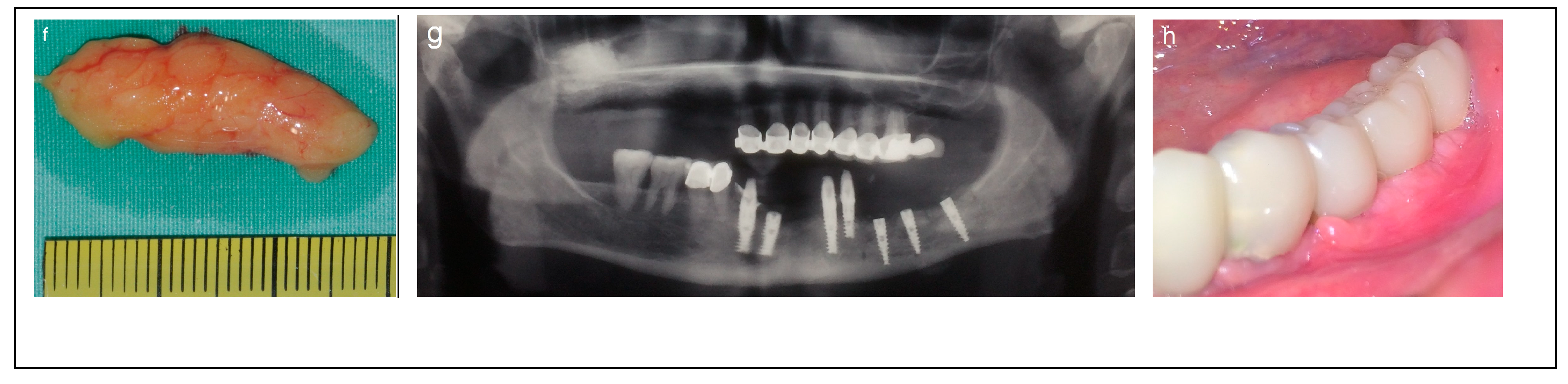 Dentistry 13 00267 g002b Dentistry 13 00267 g002b