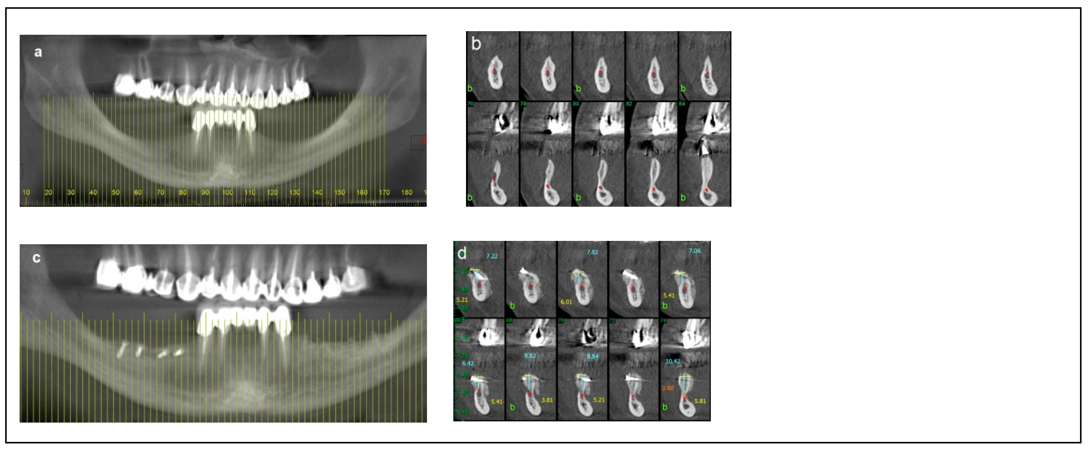 Dentistry 13 00267 g003a Dentistry 13 00267 g003a