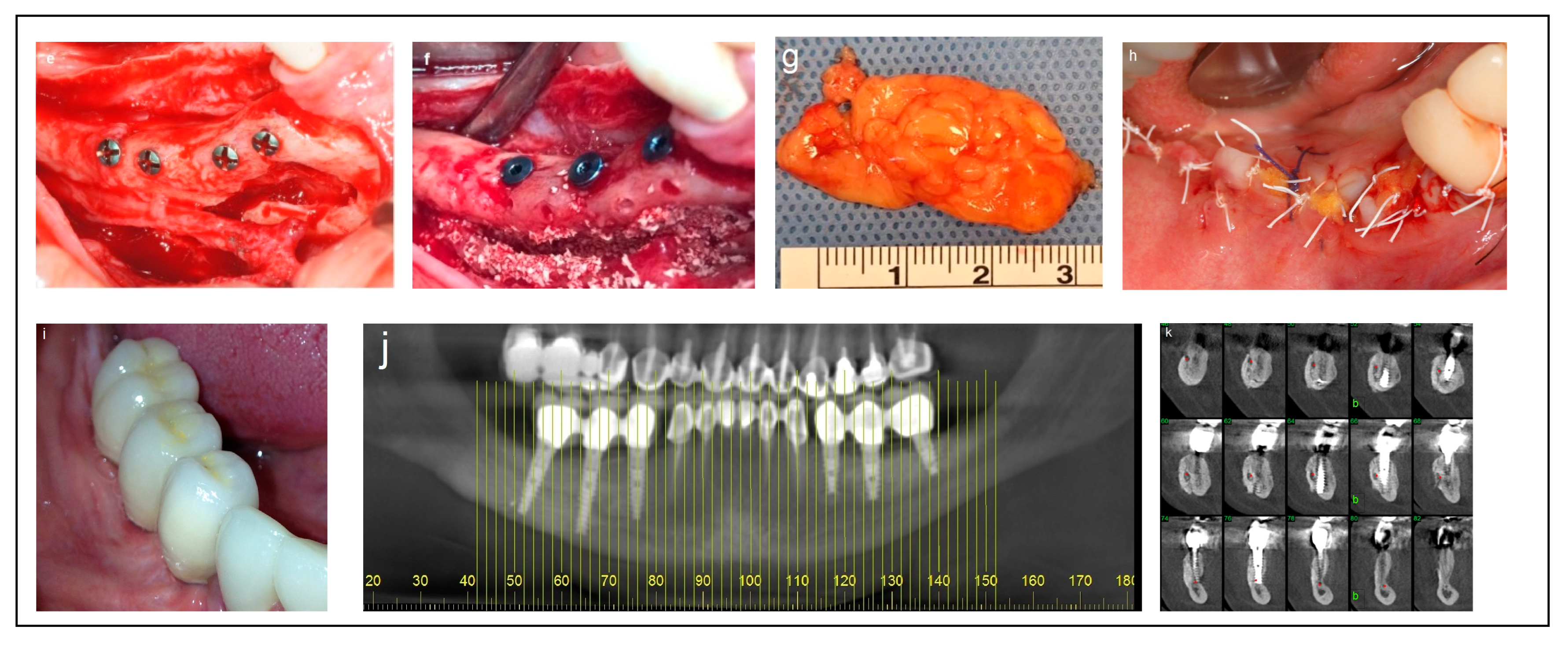 Dentistry 13 00267 g003b Dentistry 13 00267 g003b