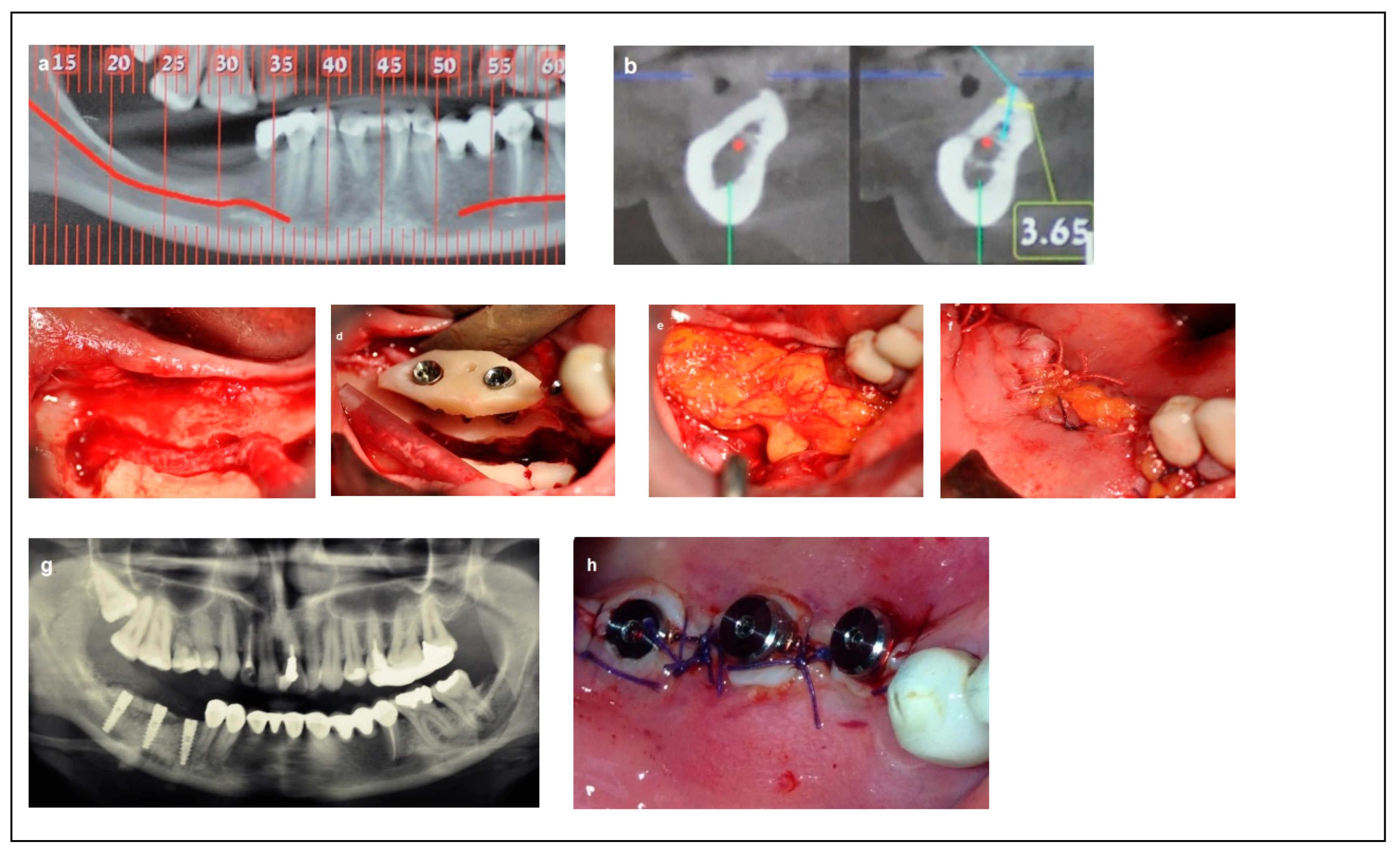 Dentistry 13 00267 g004 Dentistry 13 00267 g004