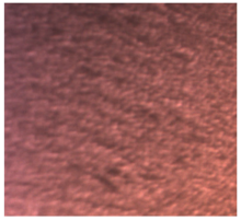 Dentistry 13 00277 i011