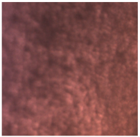 Dentistry 13 00277 i013