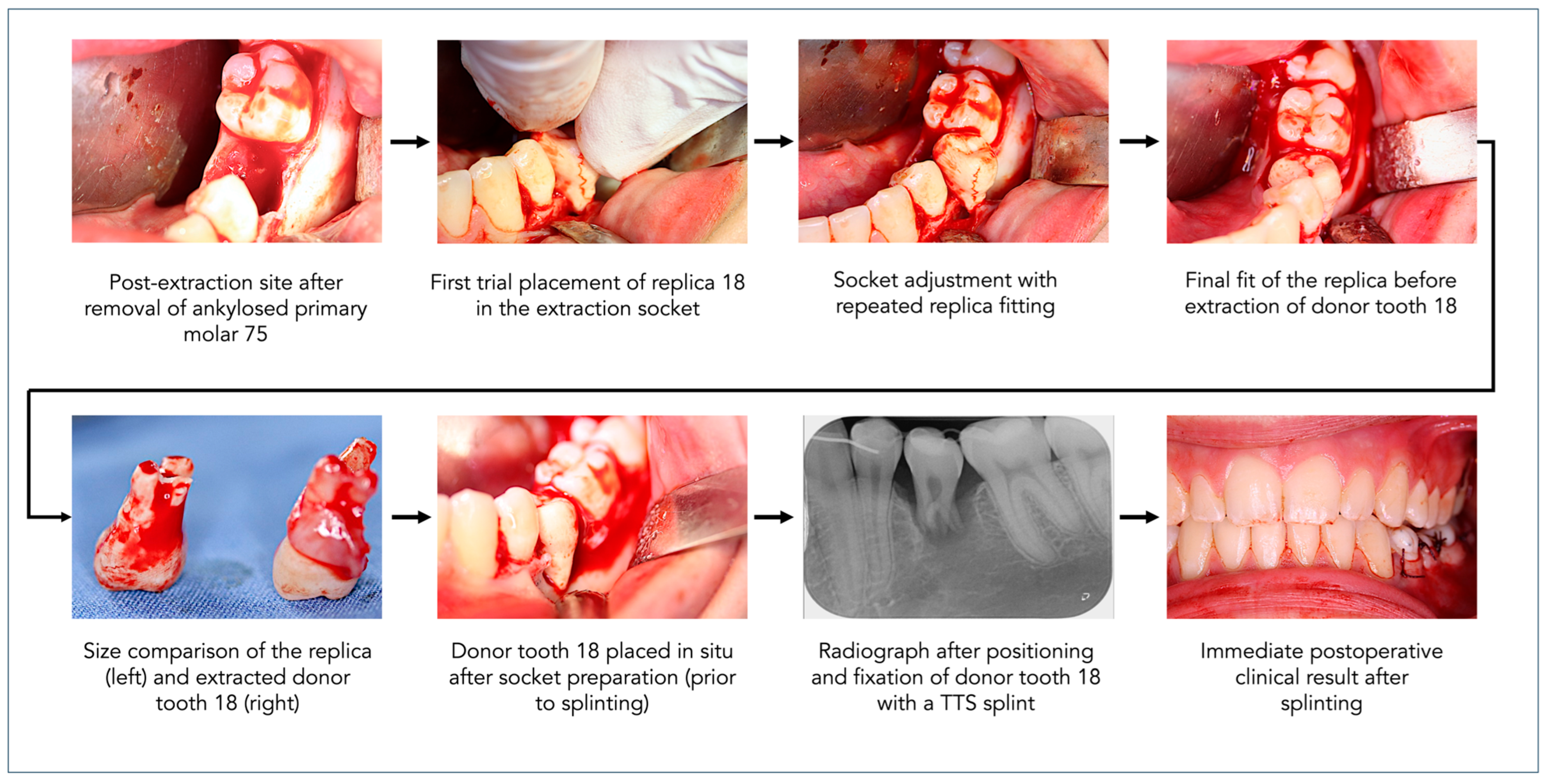 Dentistry 13 00281 g002