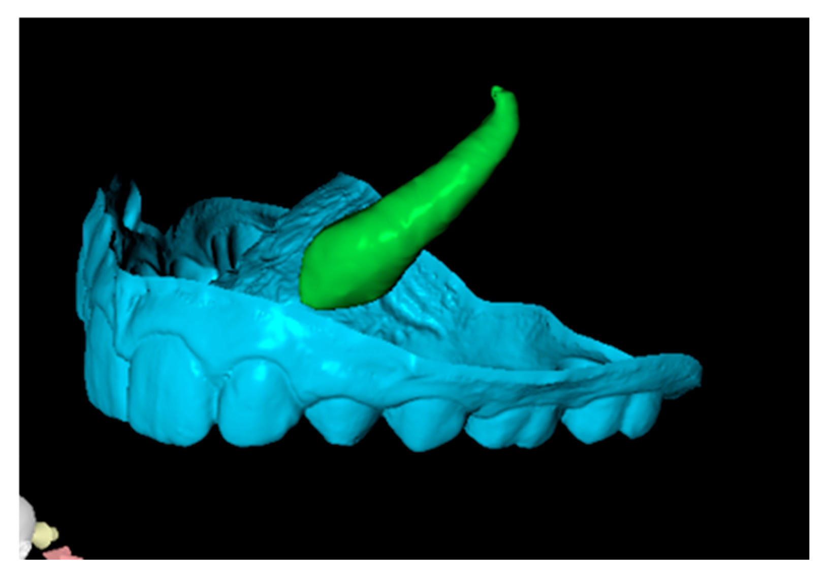 Dentistry 13 00286 g005