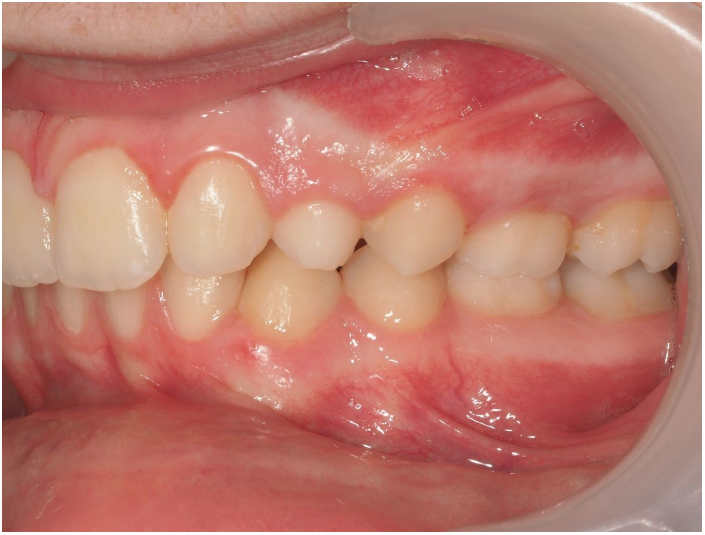 Dentistry 13 00286 g012