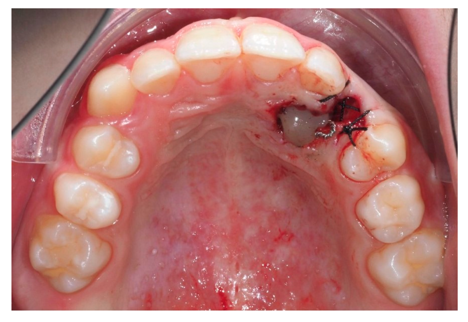 Dentistry 13 00286 g014