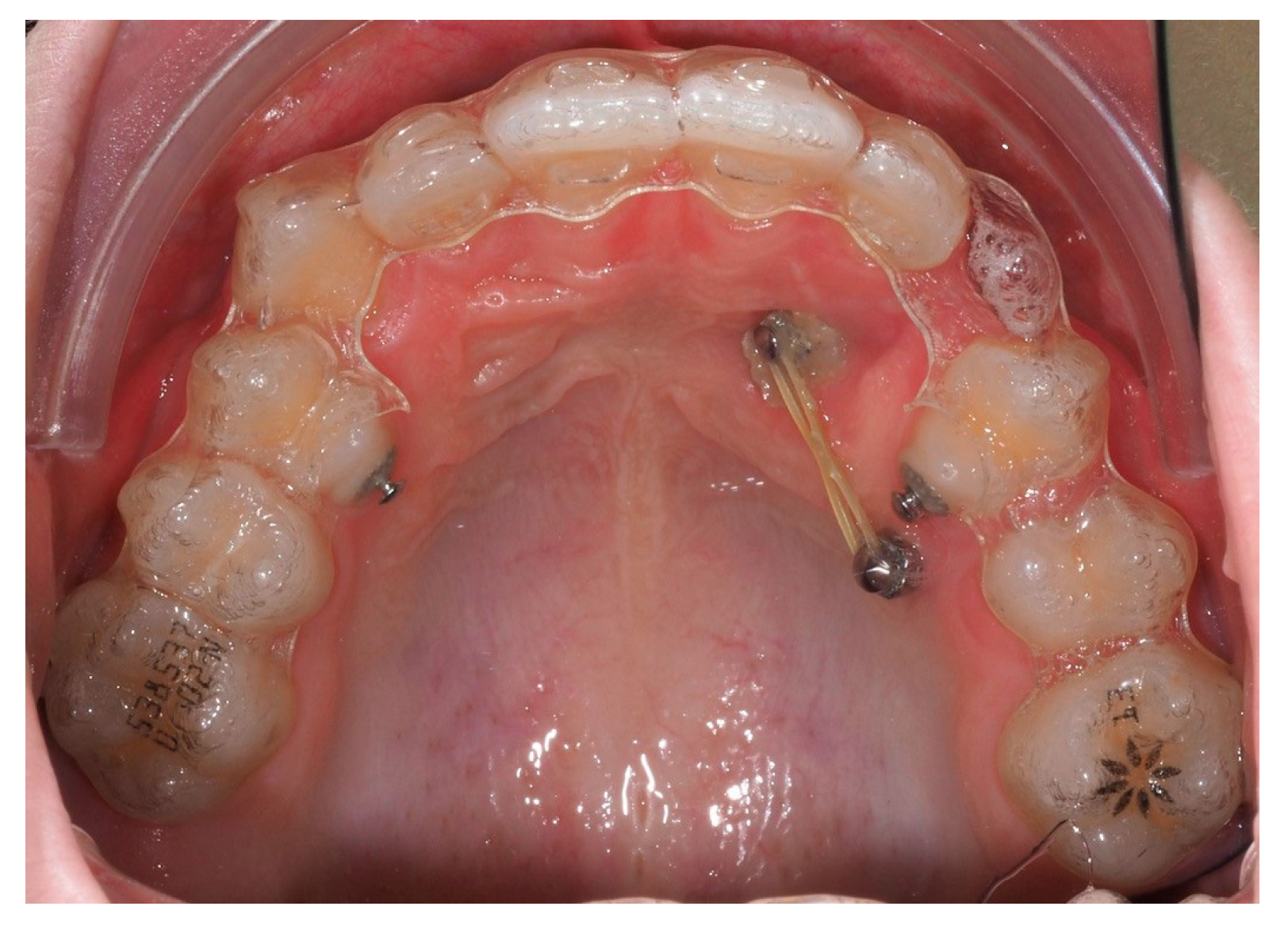 Dentistry 13 00286 g015