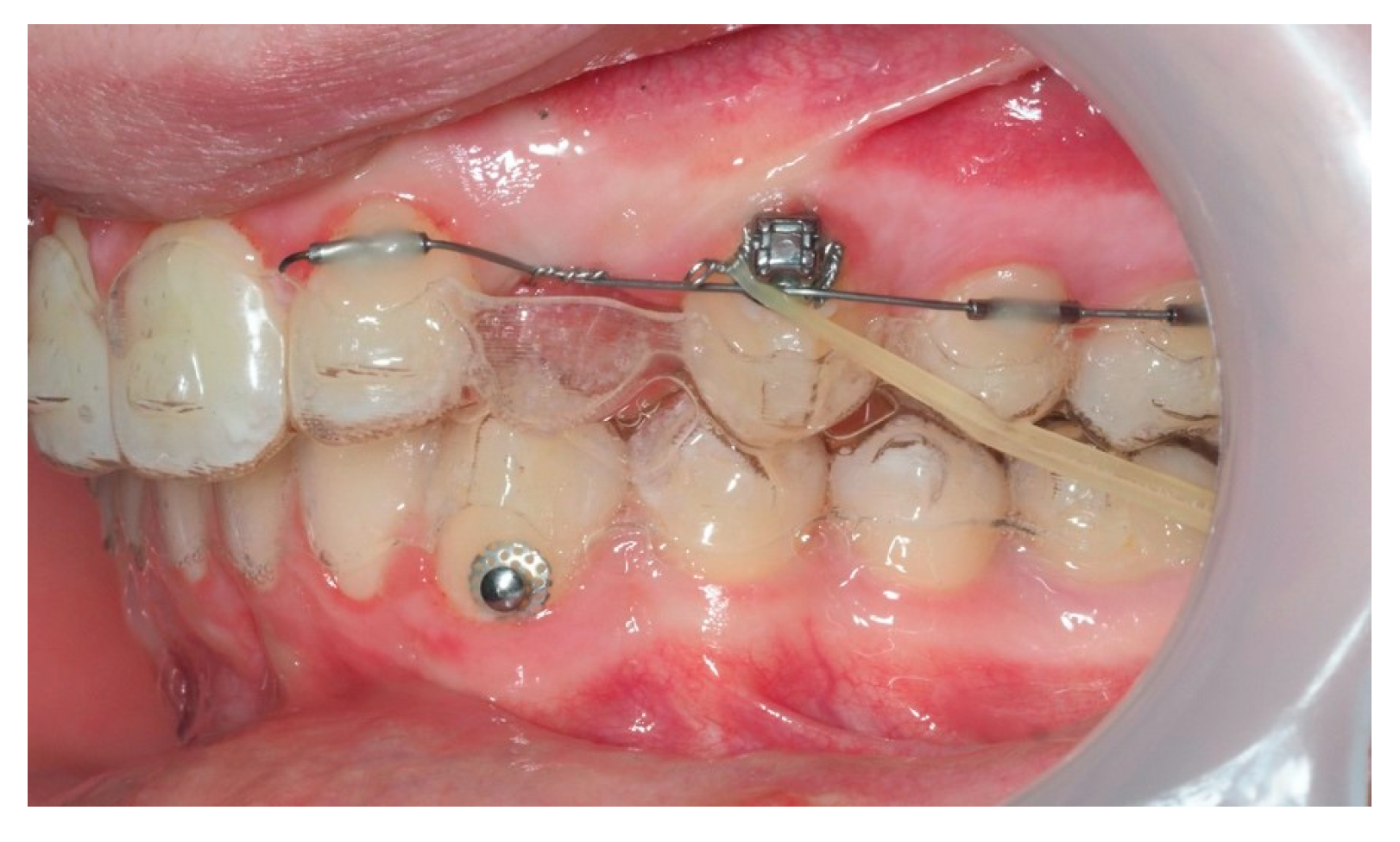 Dentistry 13 00286 g016