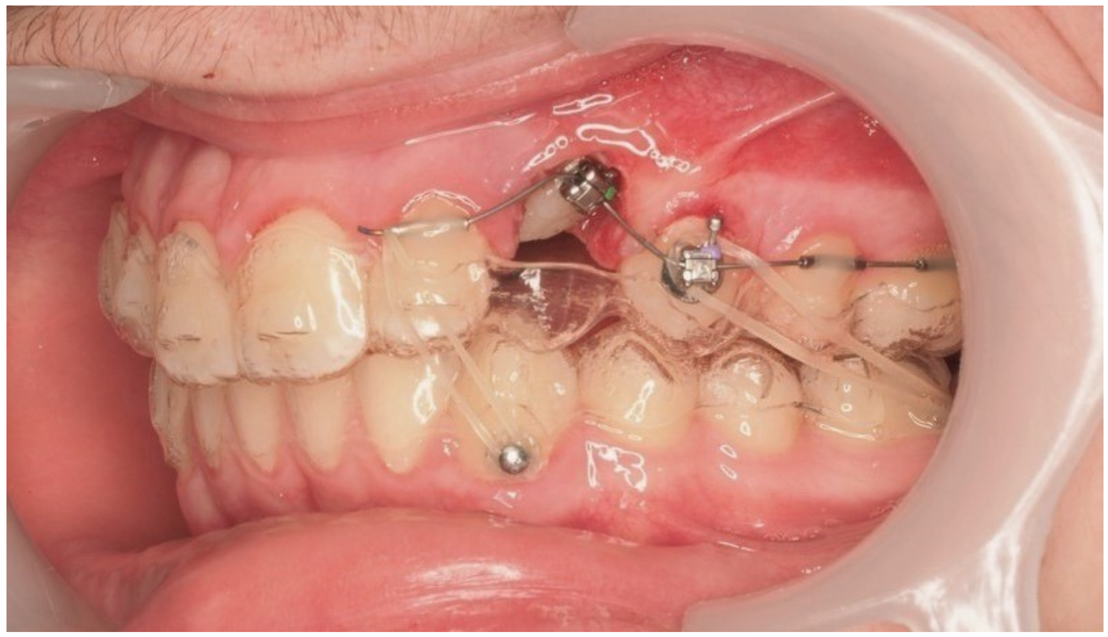 Dentistry 13 00286 g018