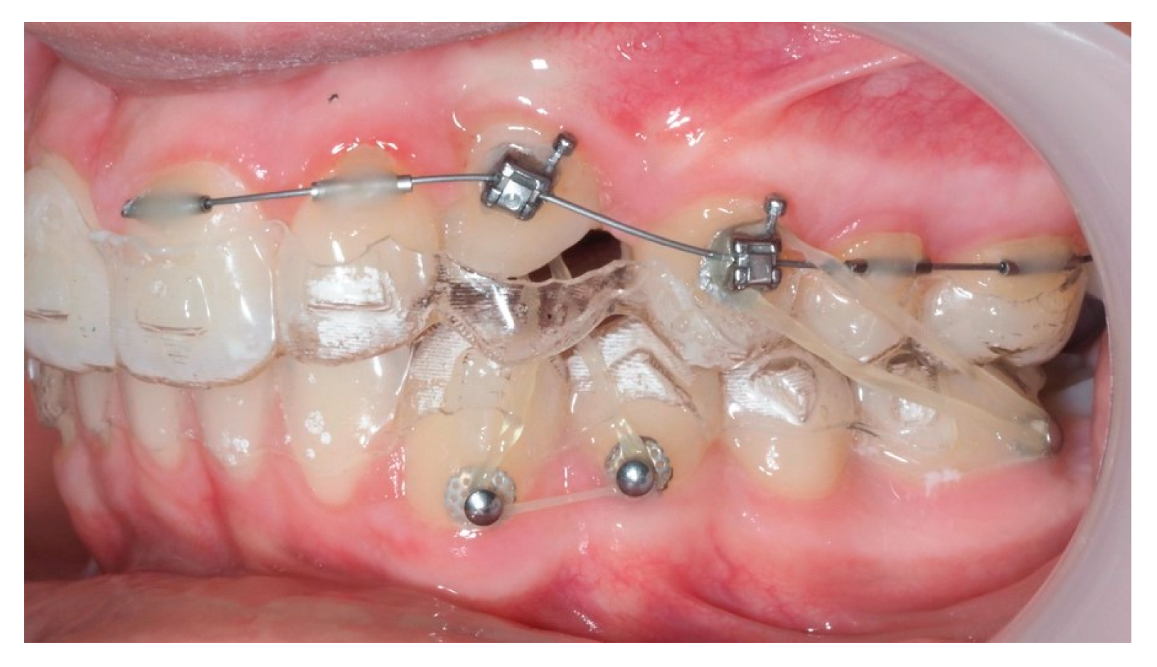 Dentistry 13 00286 g019