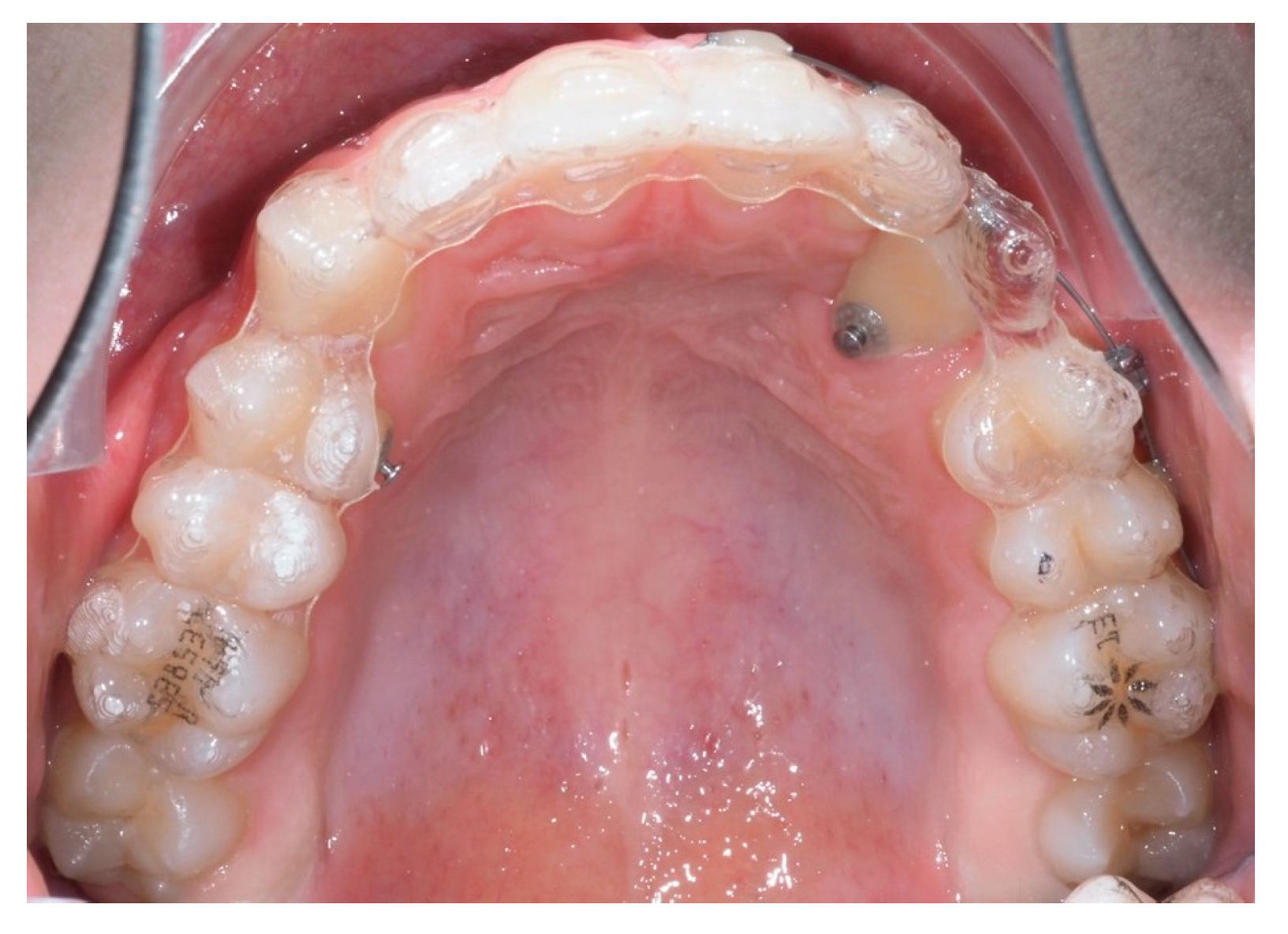 Dentistry 13 00286 g020