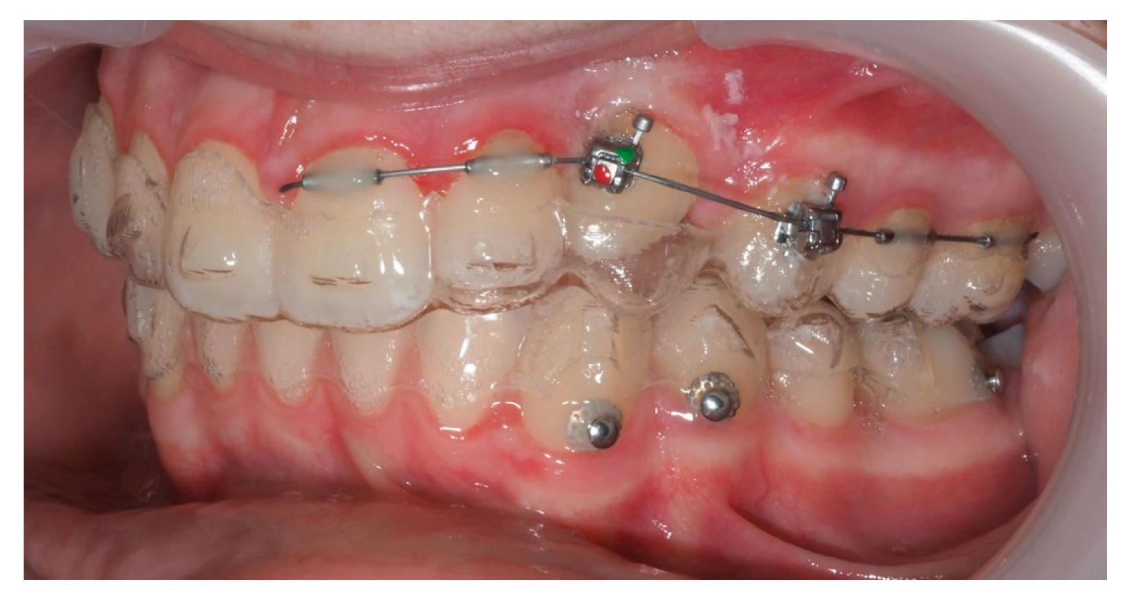 Dentistry 13 00286 g021