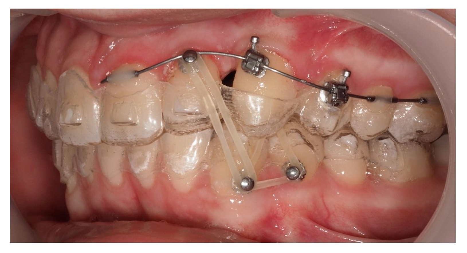 Dentistry 13 00286 g022