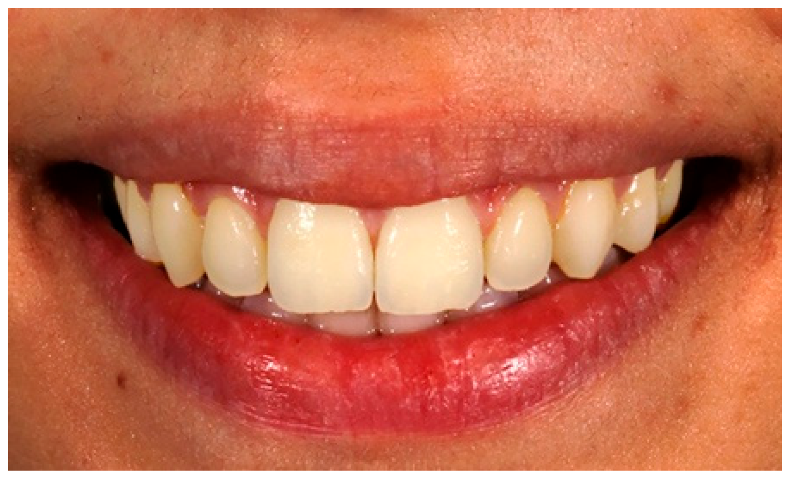 Dentistry 13 00287 g002 Dentistry 13 00287 g002