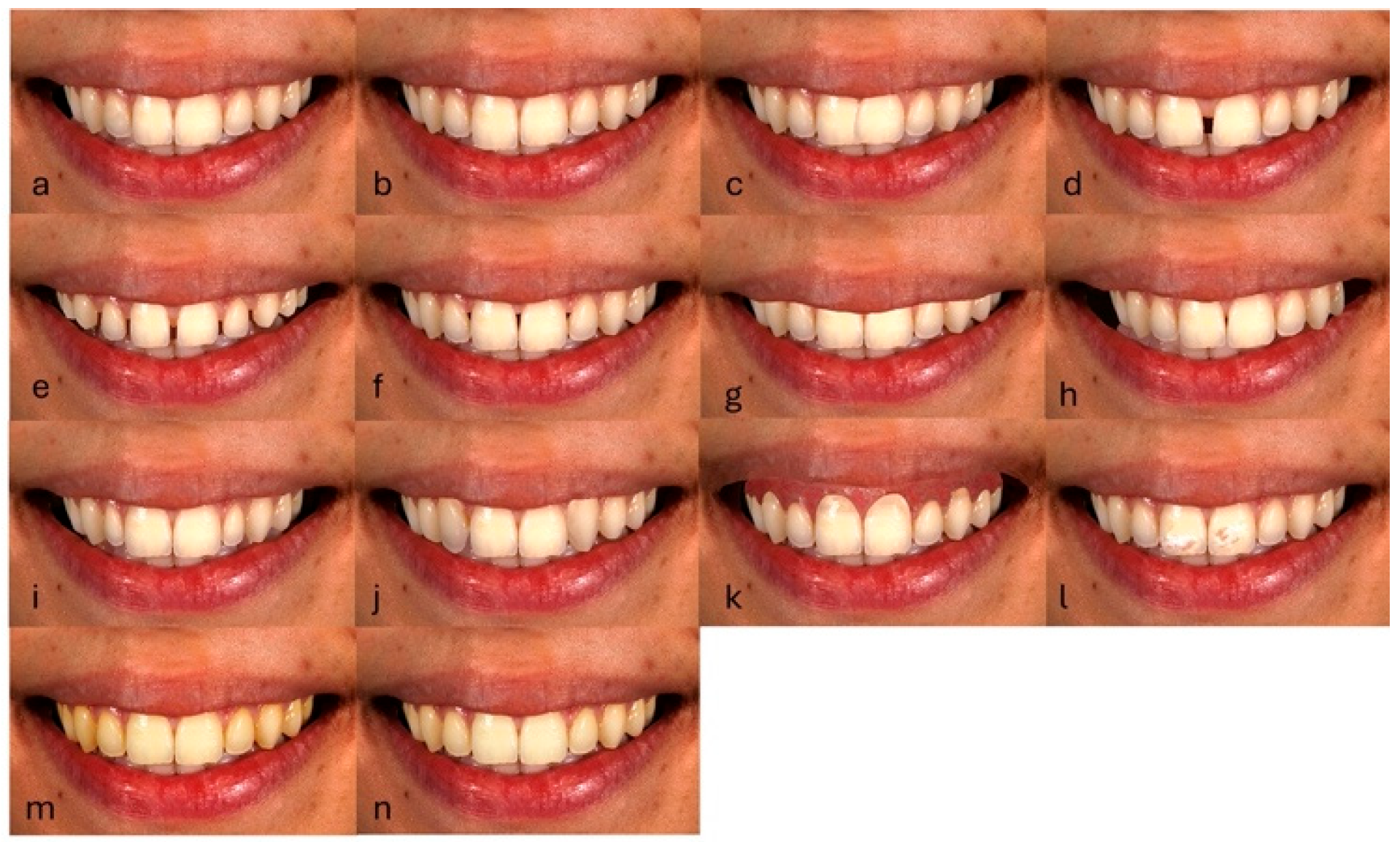 Dentistry 13 00287 g003 Dentistry 13 00287 g003