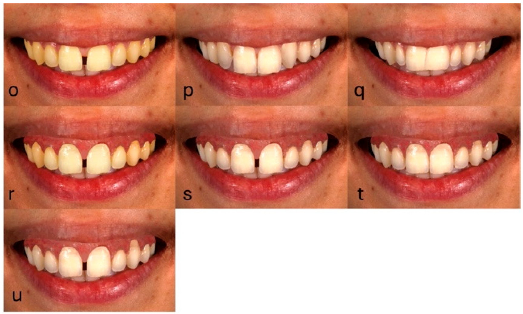 Dentistry 13 00287 g004 Dentistry 13 00287 g004