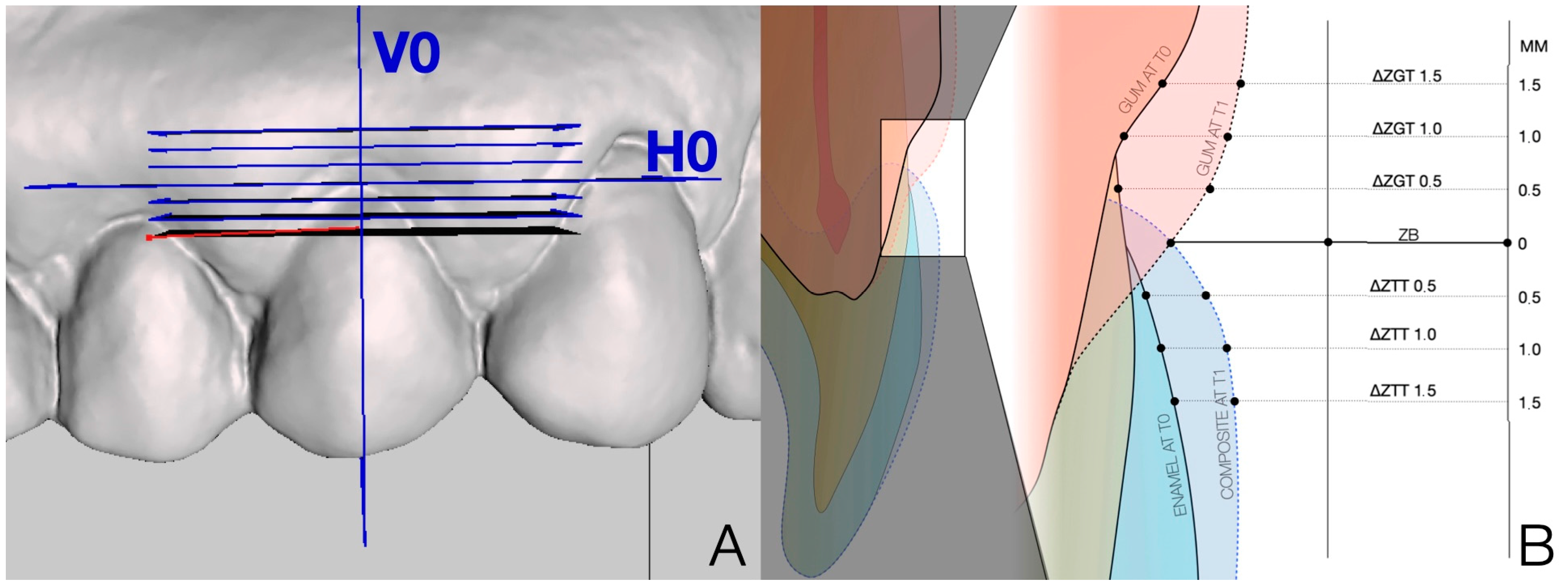 Dentistry 13 00296 g004