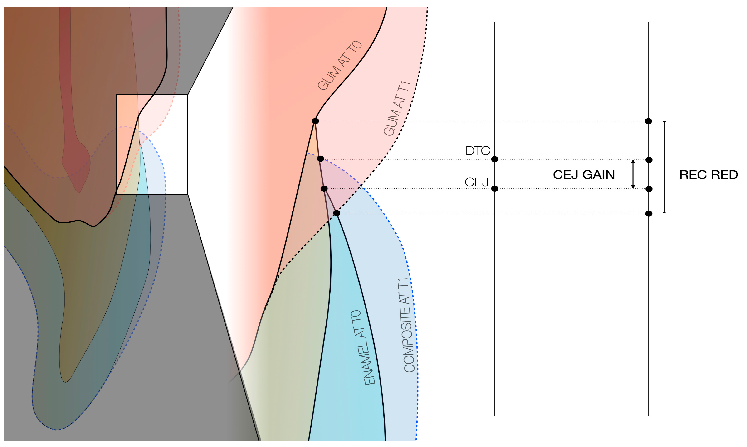 Dentistry 13 00296 g006