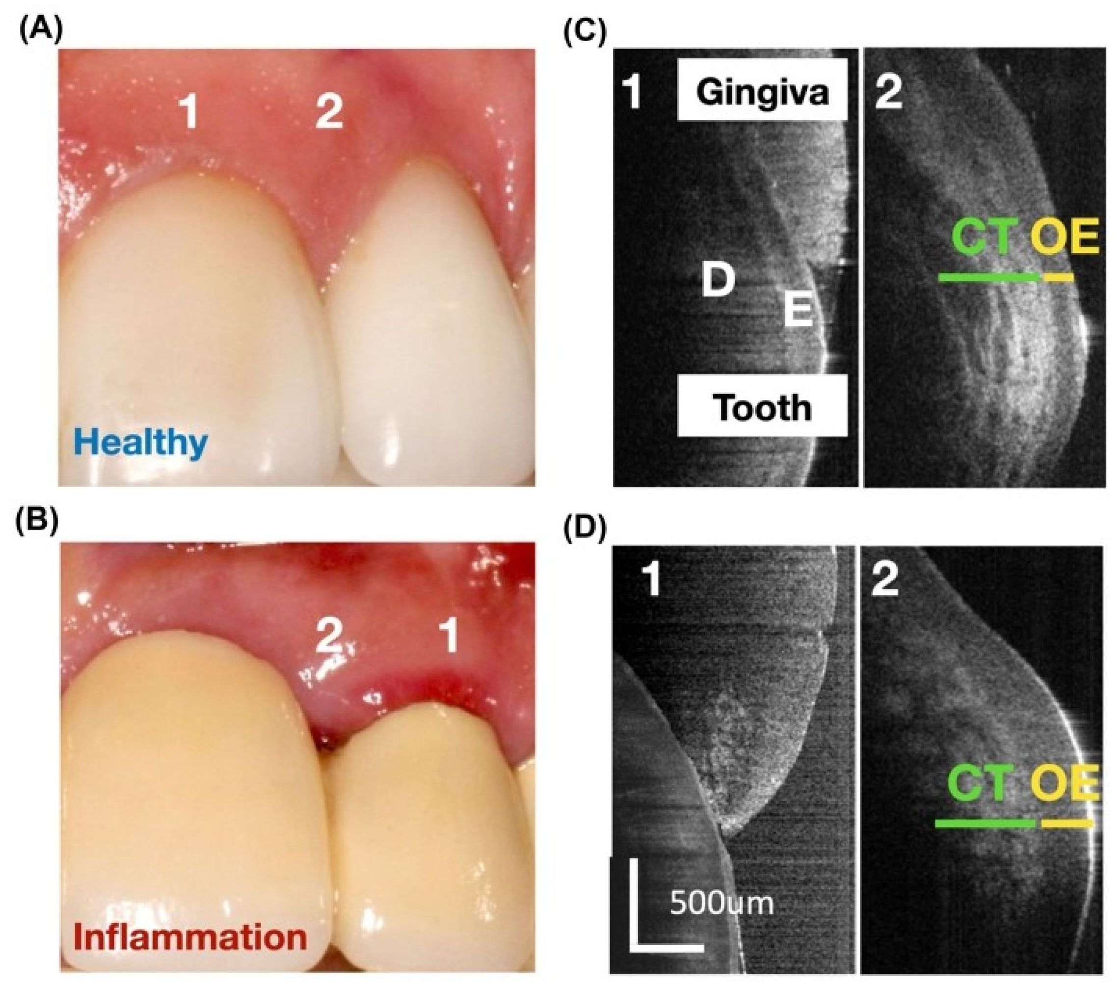 Dentistry 13 00305 g004