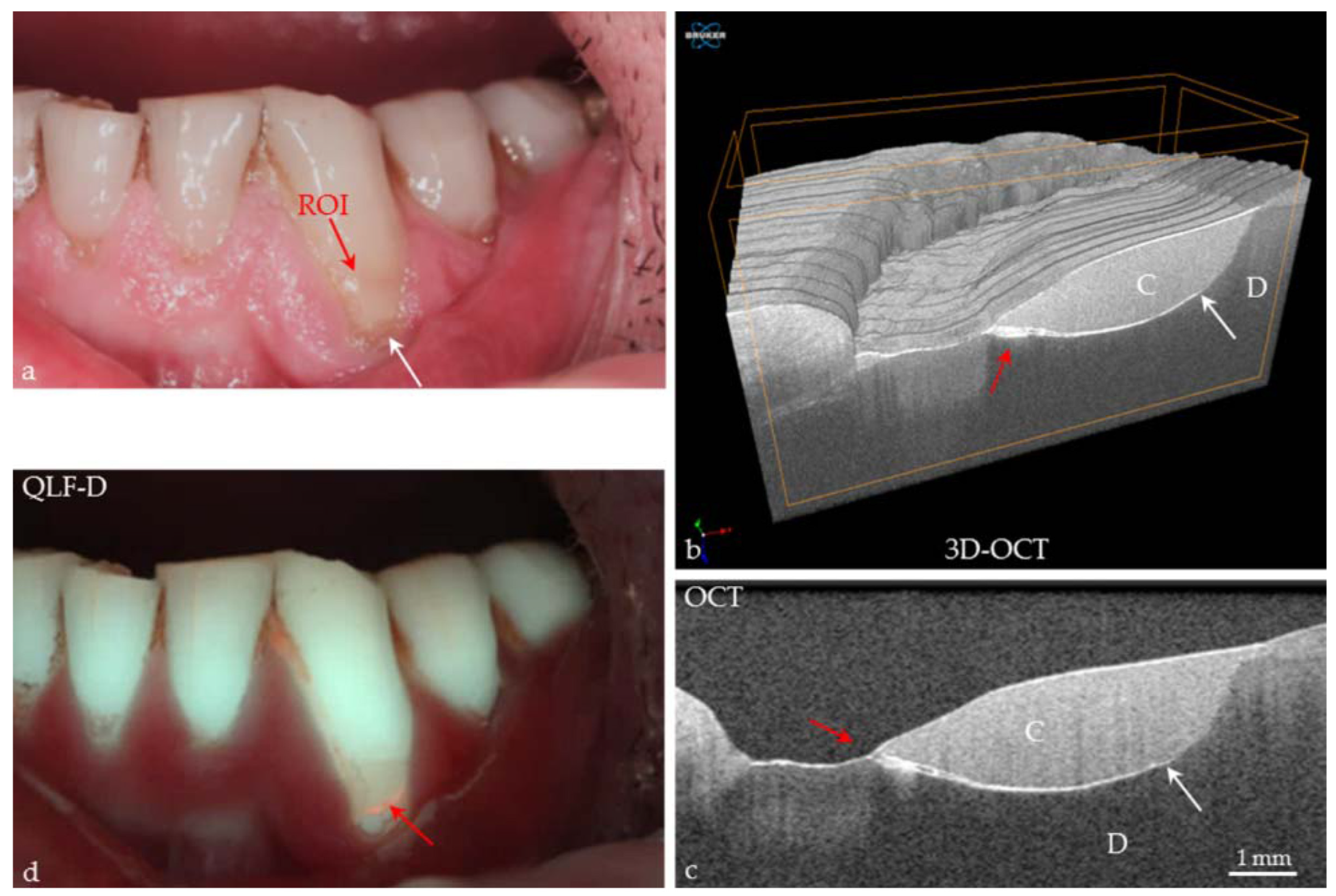 Dentistry 13 00305 g006