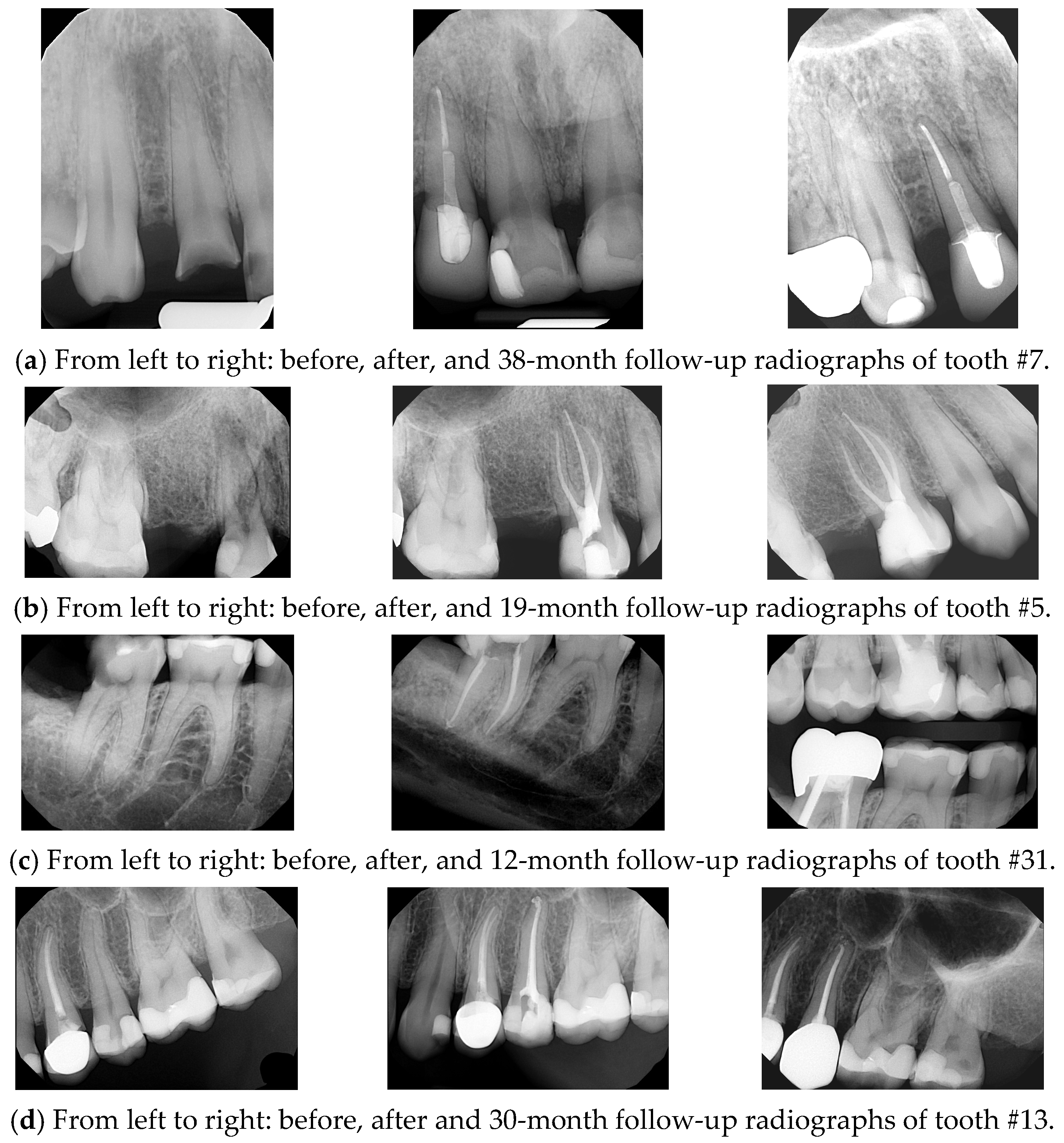 Dentistry 13 00306 g001a