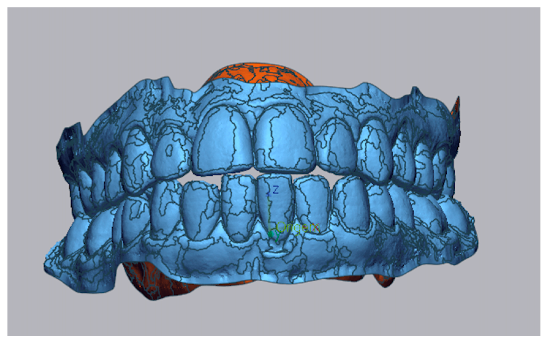 Dentistry 13 00316 g001