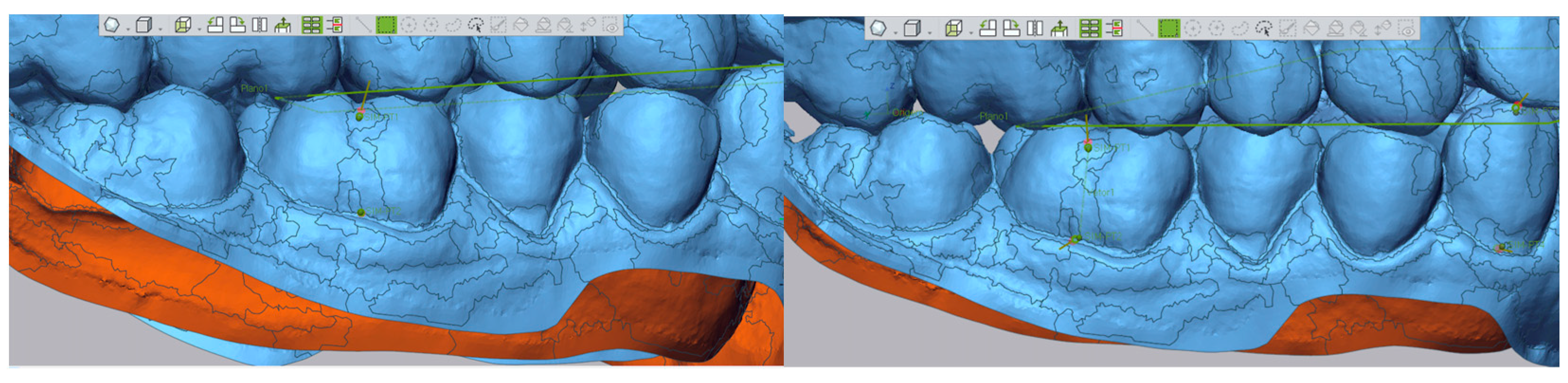 Dentistry 13 00316 g003