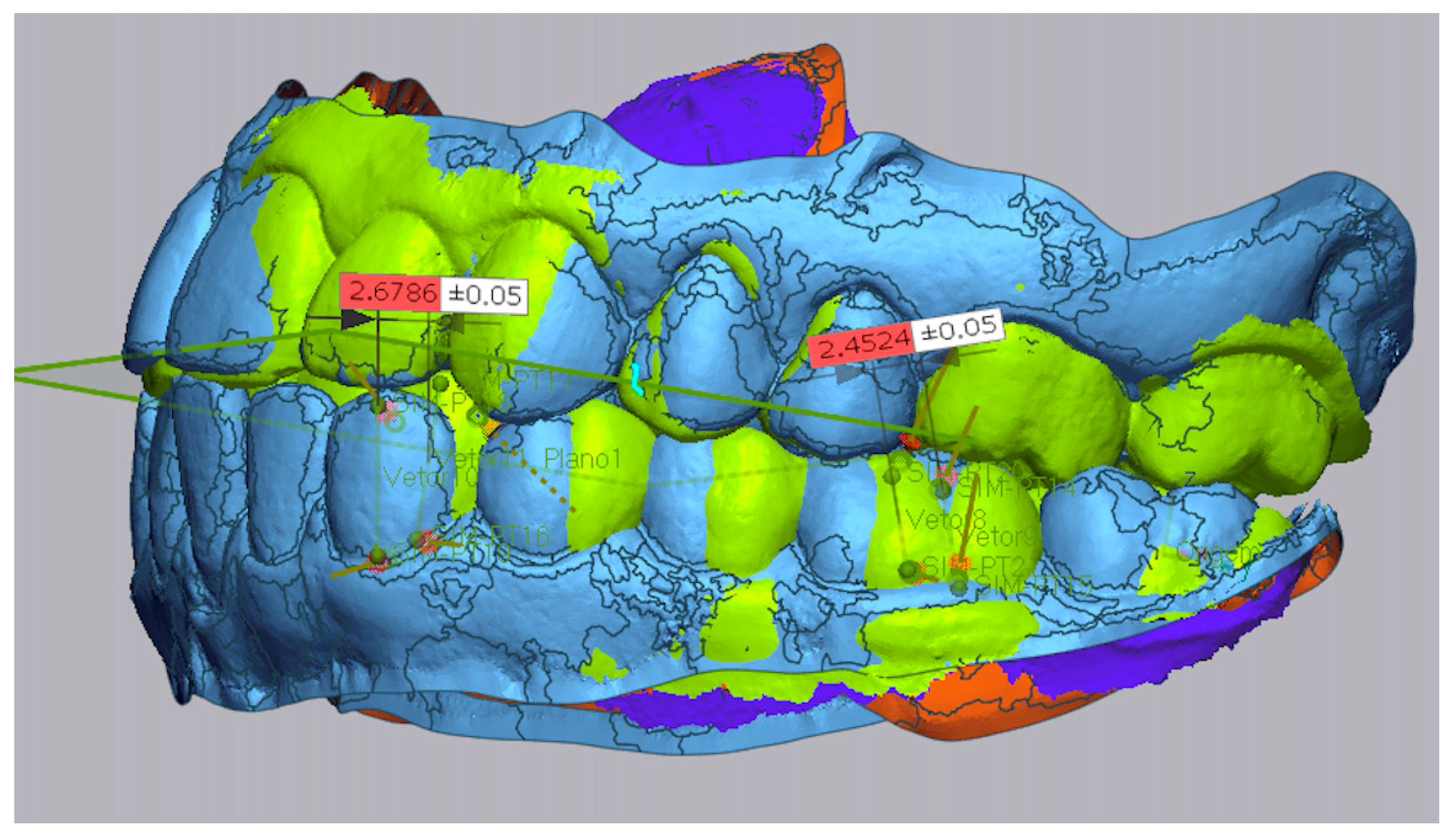 Dentistry 13 00316 g004