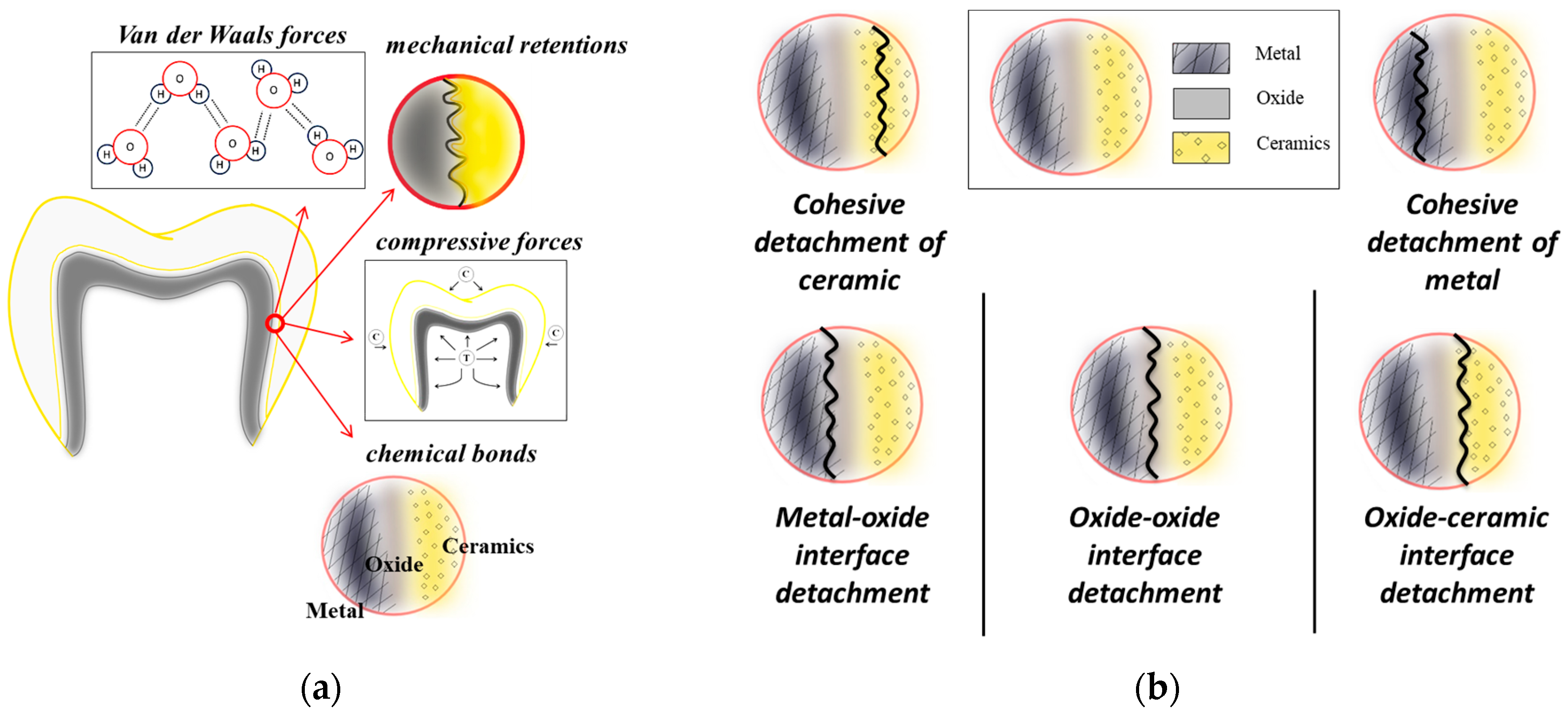 Dentistry 13 00318 g001 Dentistry 13 00318 g001