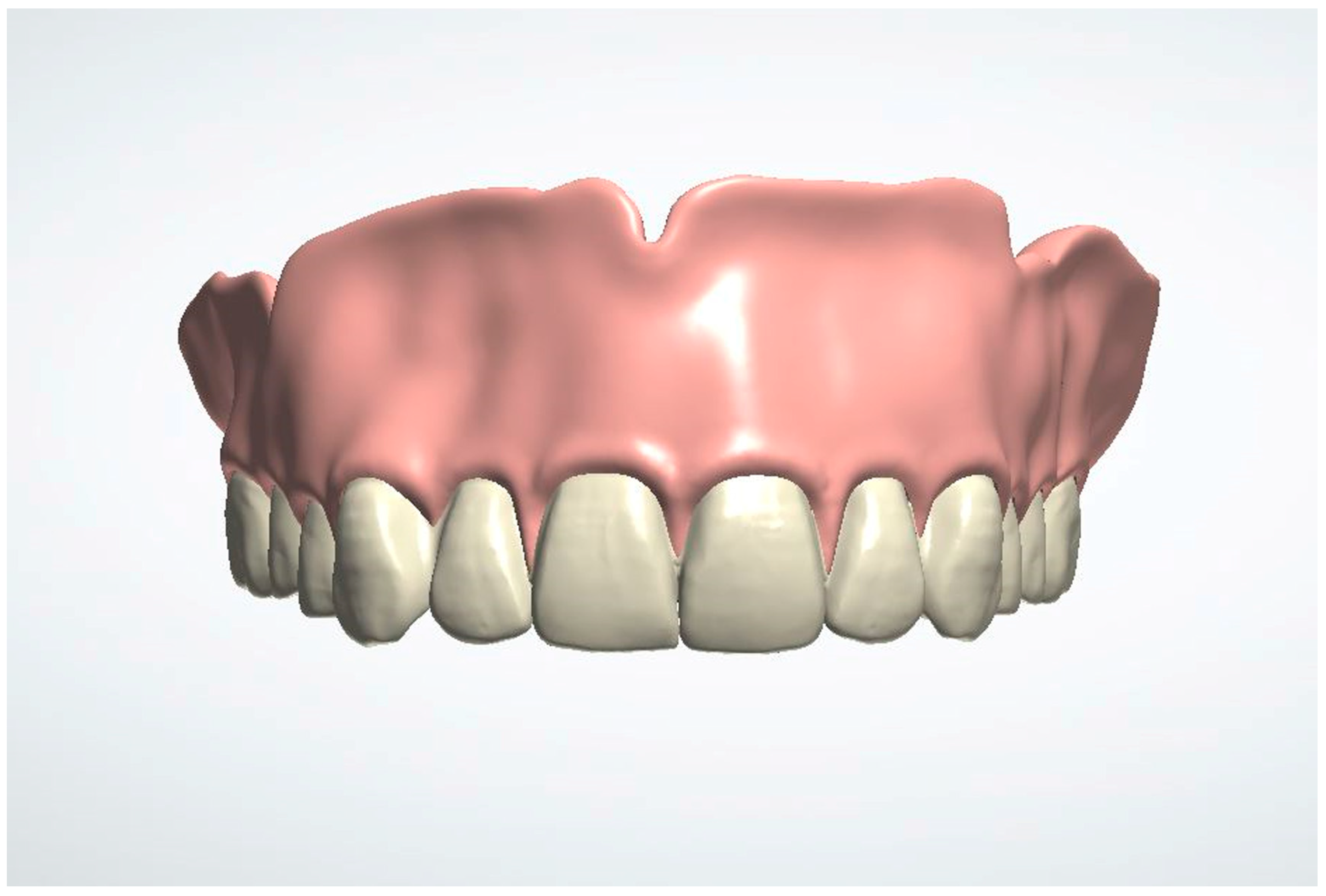 Dentistry 13 00333 g004