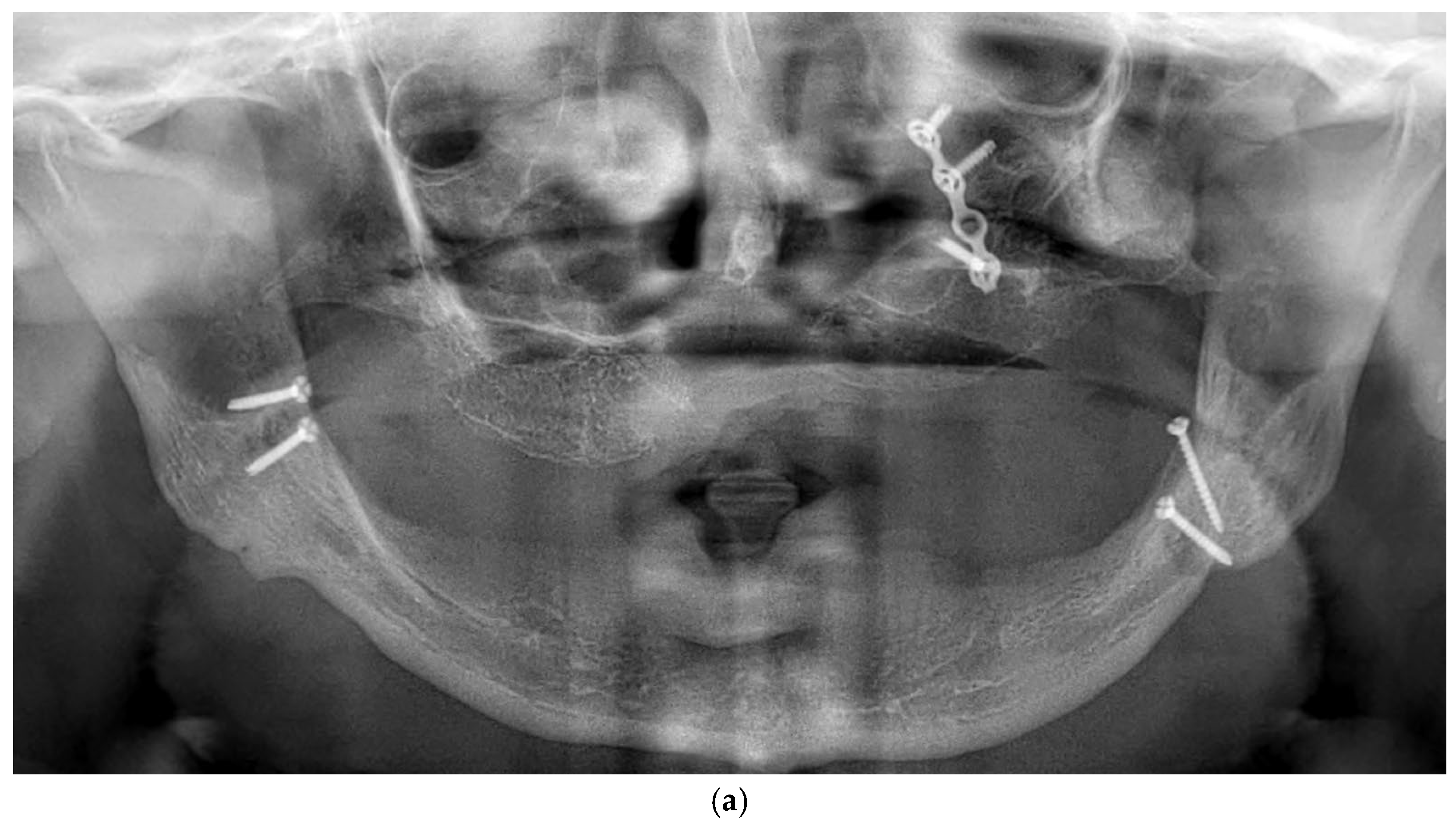 Dentistry 13 00337 g002a