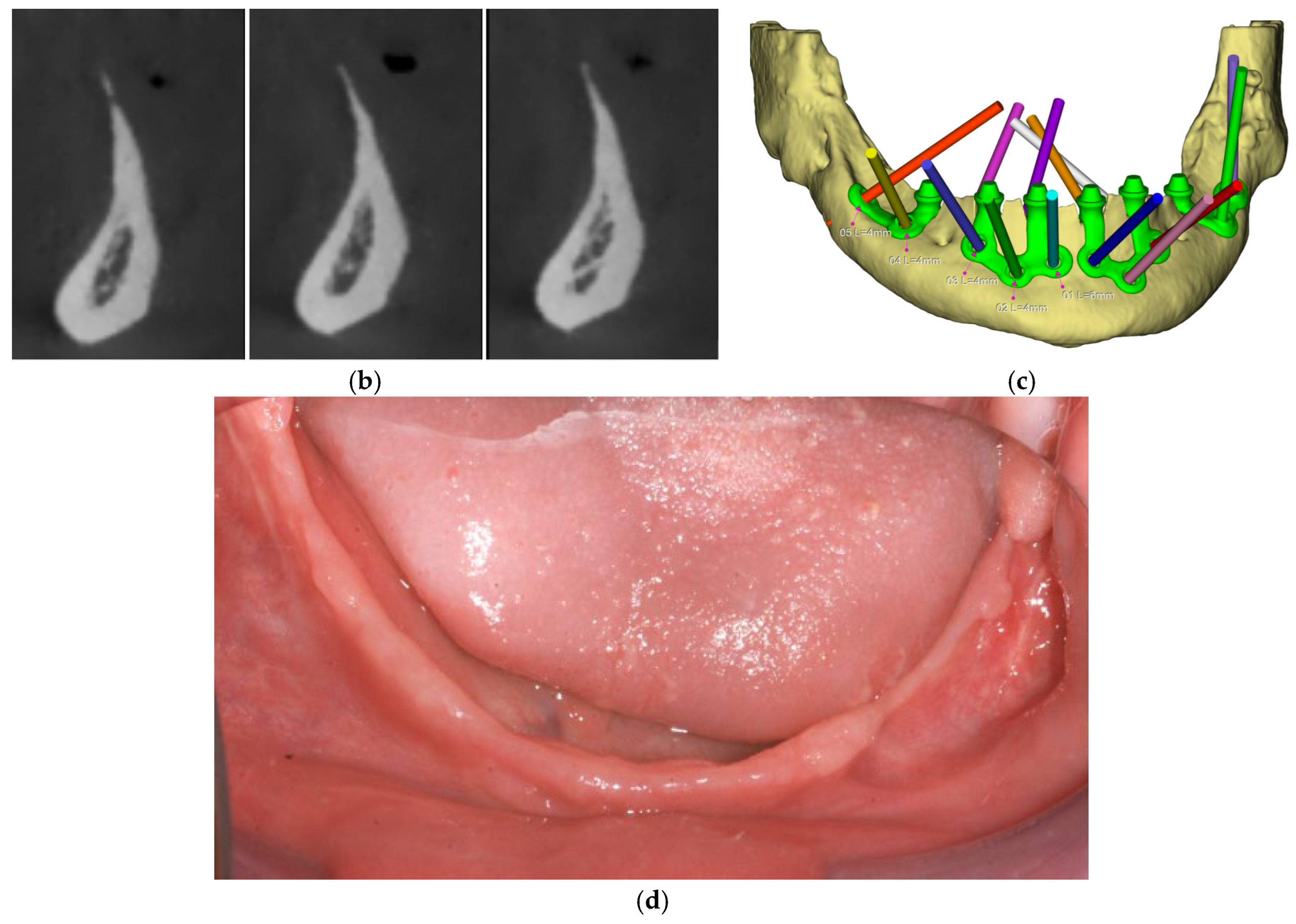 Dentistry 13 00337 g002b