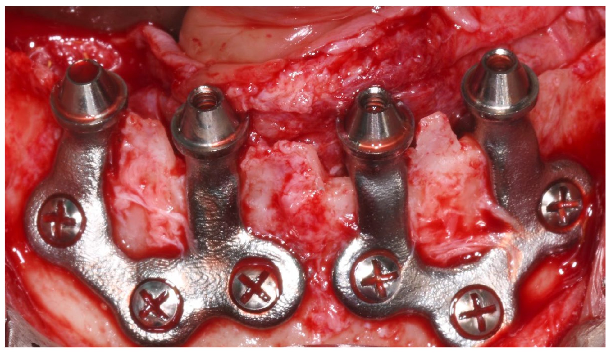 Dentistry 13 00337 g004