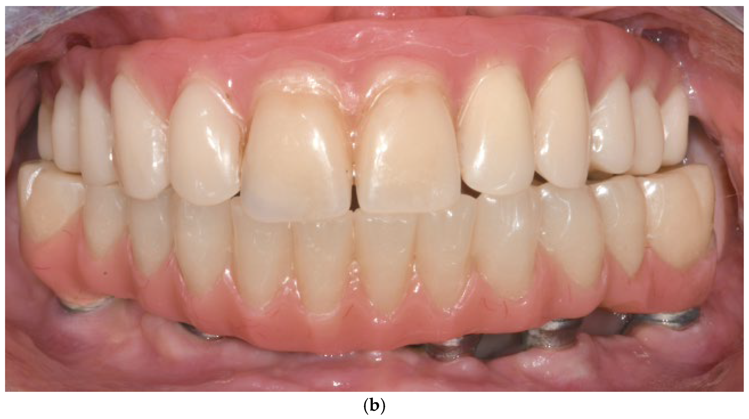 Dentistry 13 00337 g006b