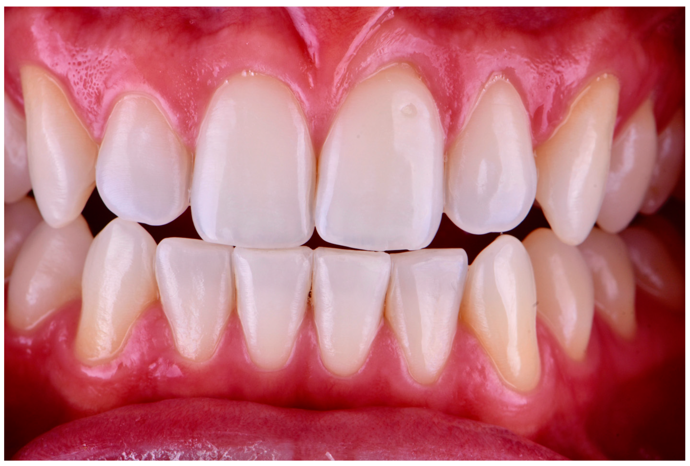 Dentistry 13 00339 g006