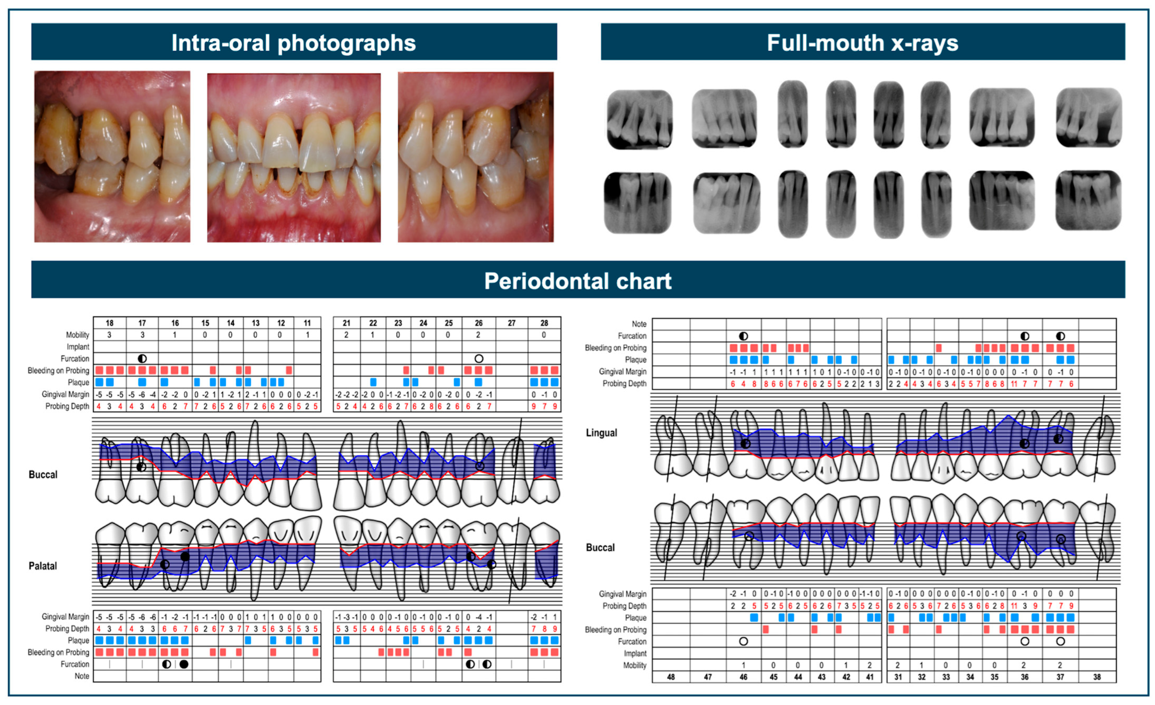 Dentistry 13 00361 g001 Dentistry 13 00361 g001