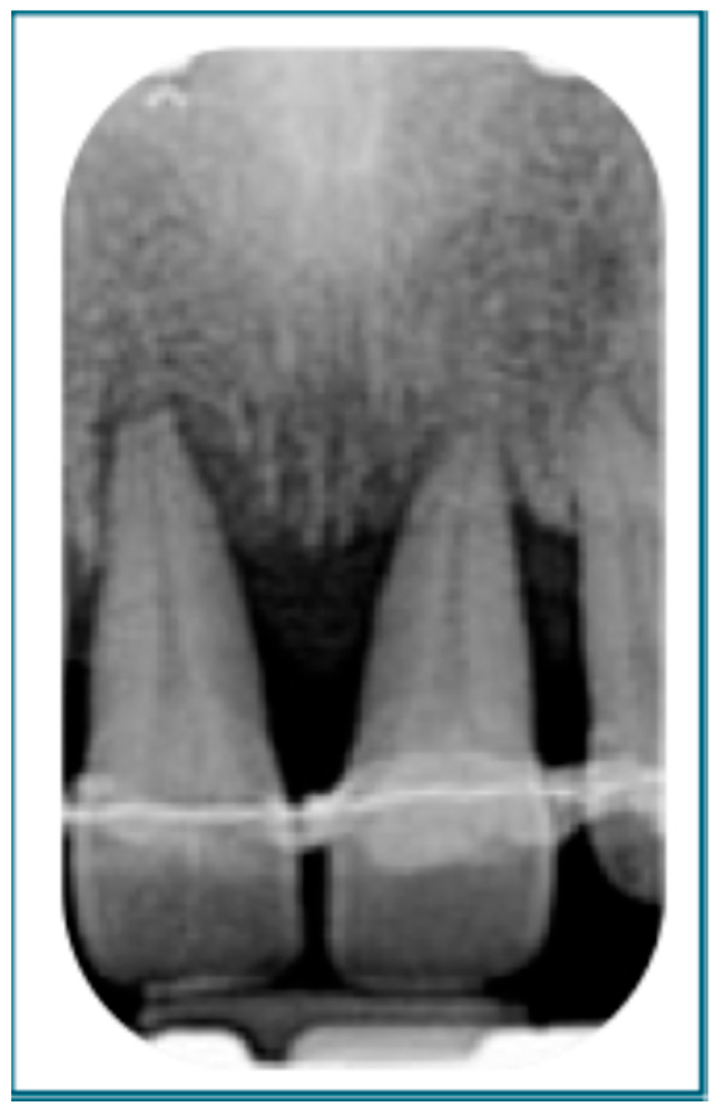 Dentistry 13 00361 g003 Dentistry 13 00361 g003