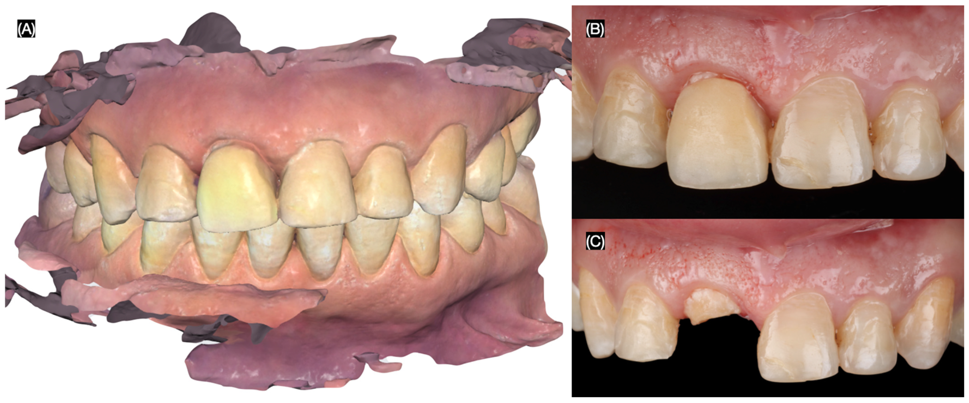 Dentistry 13 00365 g001 Dentistry 13 00365 g001