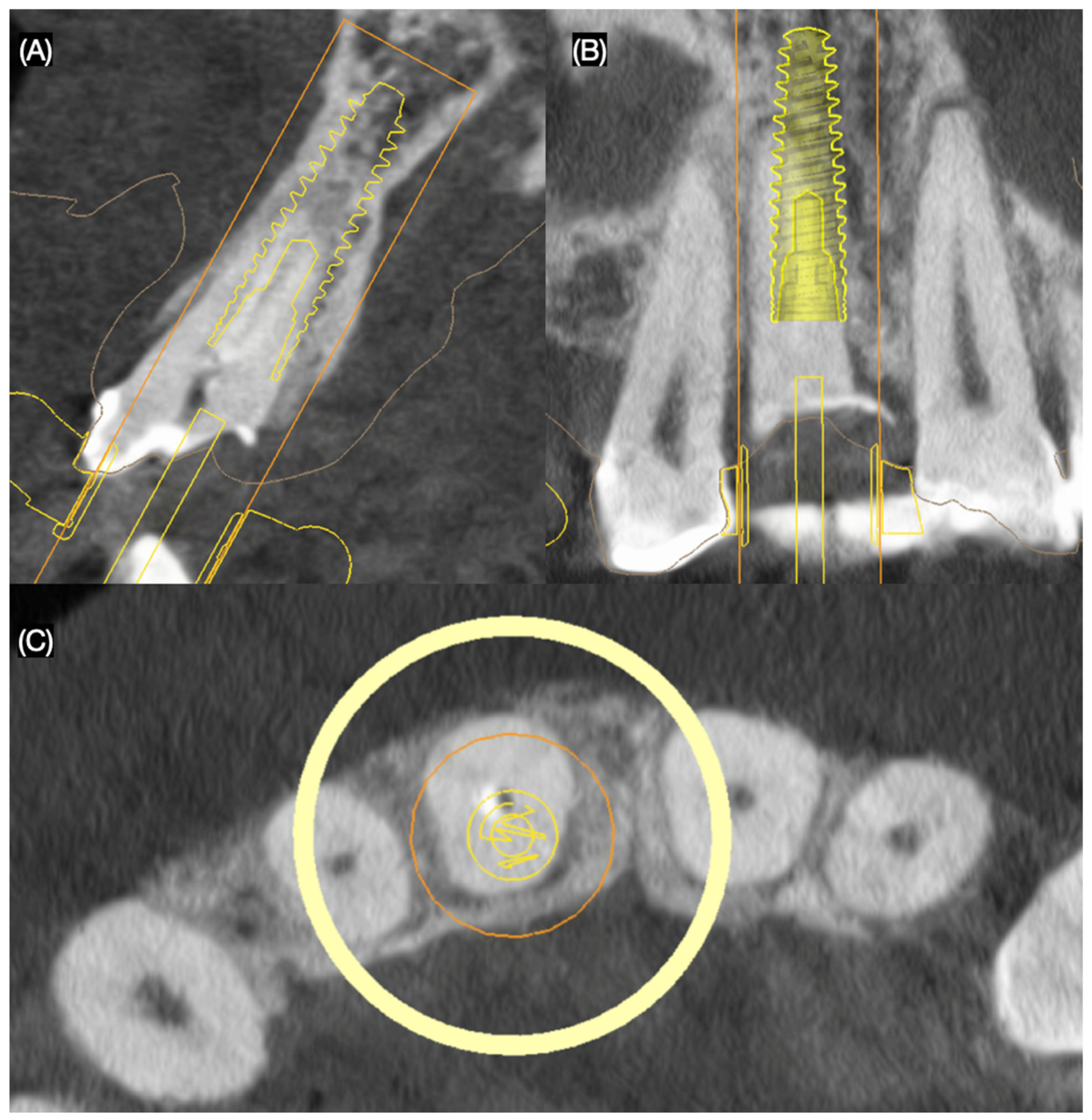 Dentistry 13 00365 g002 Dentistry 13 00365 g002